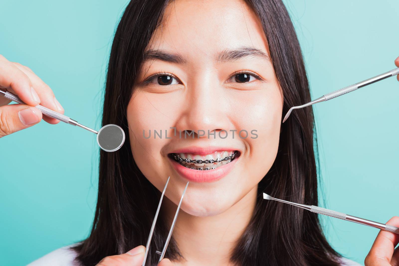 Asian teen beautiful young woman smile have dental braces on teeth laughing and have medical equipment tools for check tooth, isolated on a blue background, Medicine and dentistry concept