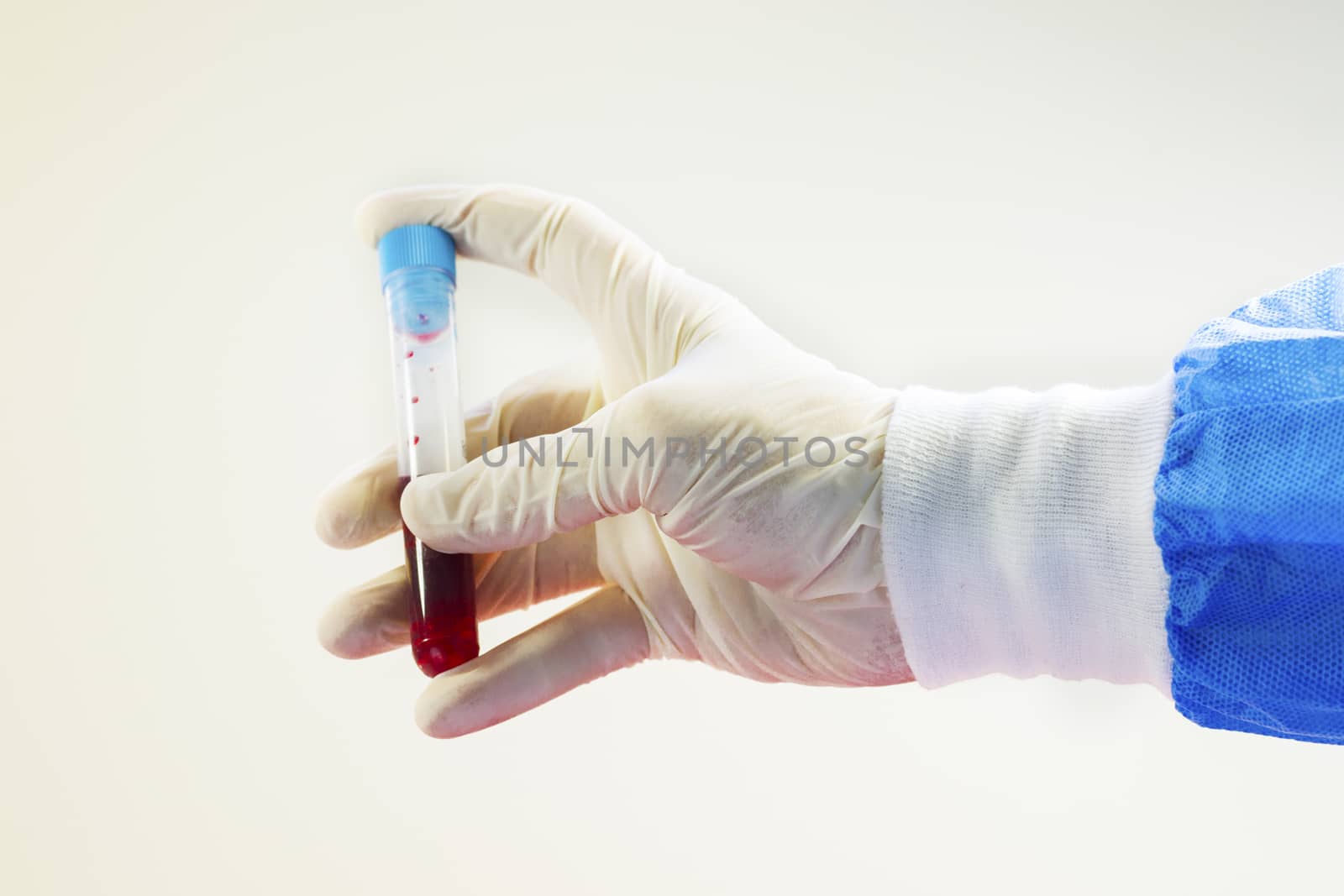 Blood test full tubes in doctor's hand with glove, on the white background, studio shoot. by Taidundua