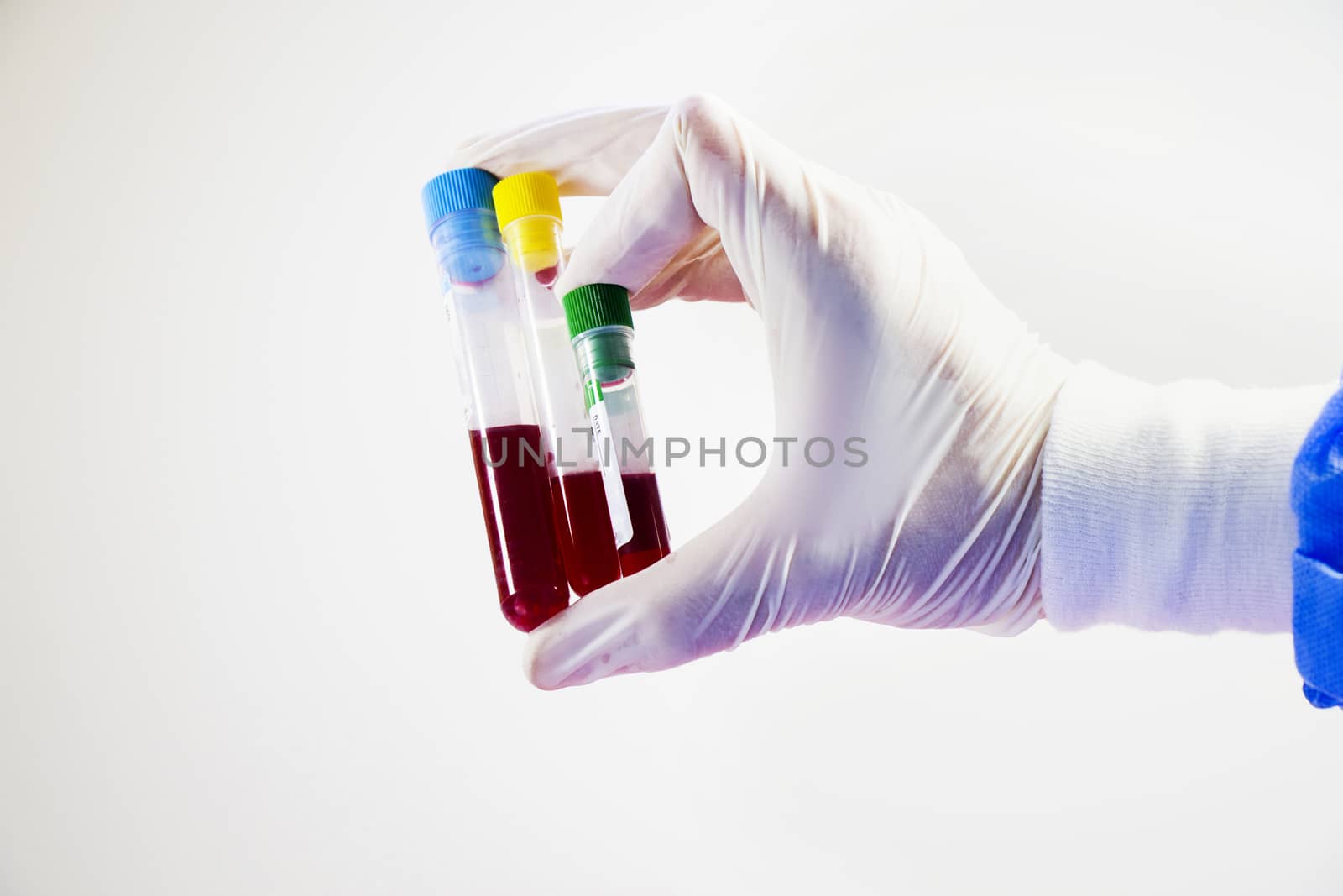 Blood test full tubes in hand, holding tubes,on the white background, studio shoot.