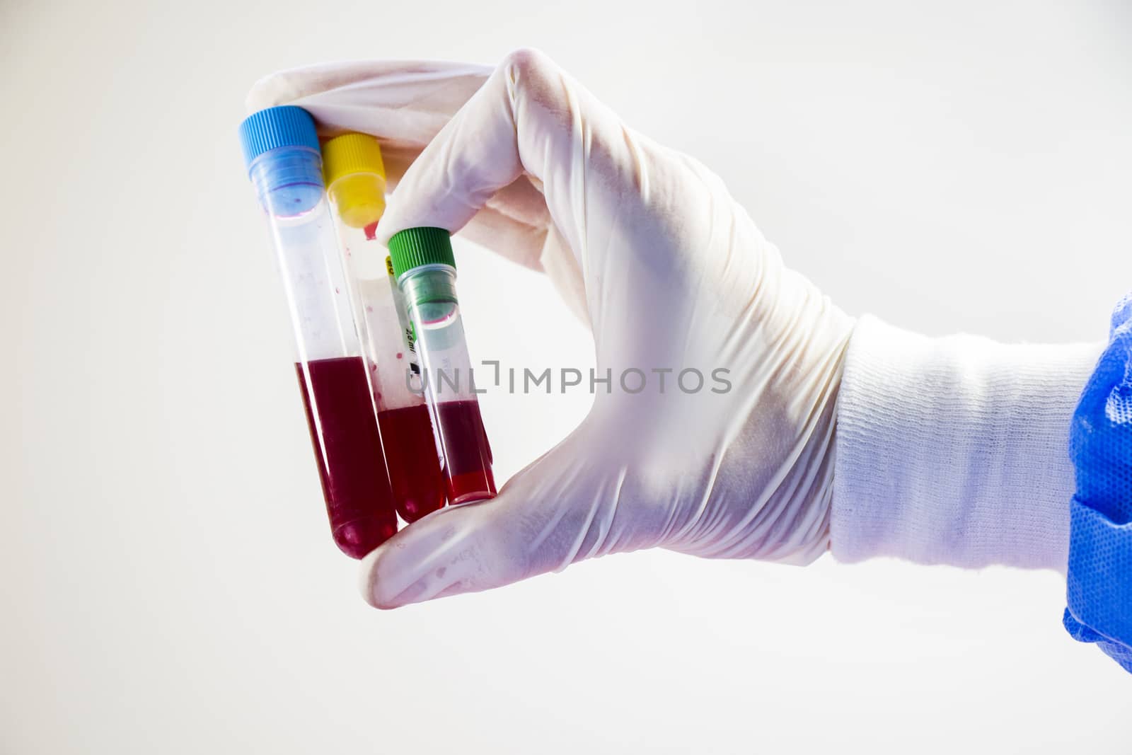 Blood test tubes in doctor hand and glove on the white background, studio shoot. by Taidundua