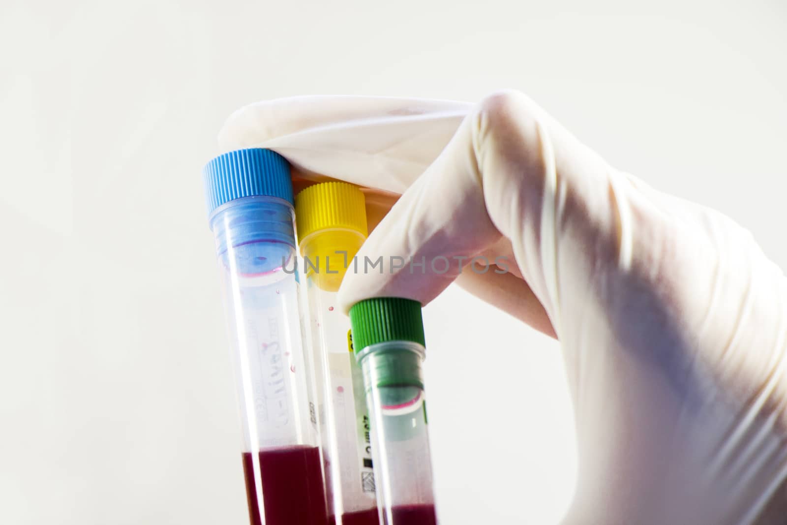 Blood test tubes in doctor hand and glove on the white background, studio shoot. by Taidundua