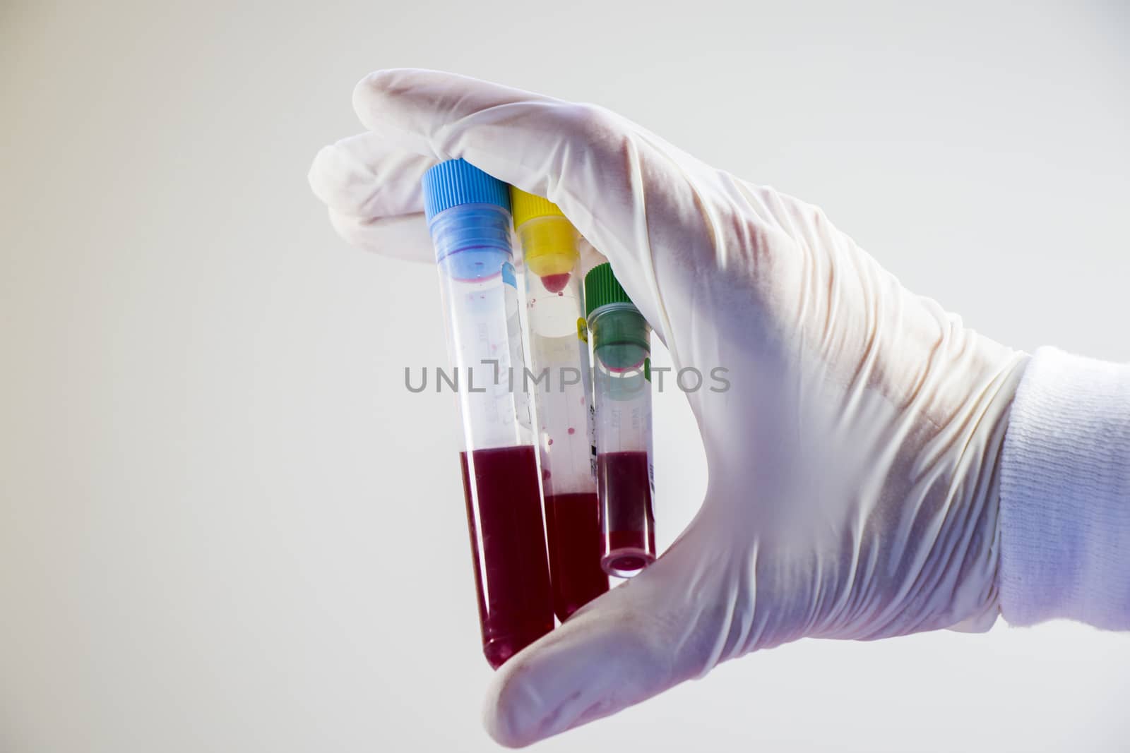 Blood test tubes in doctor hand and glove on the white background, studio shoot. by Taidundua