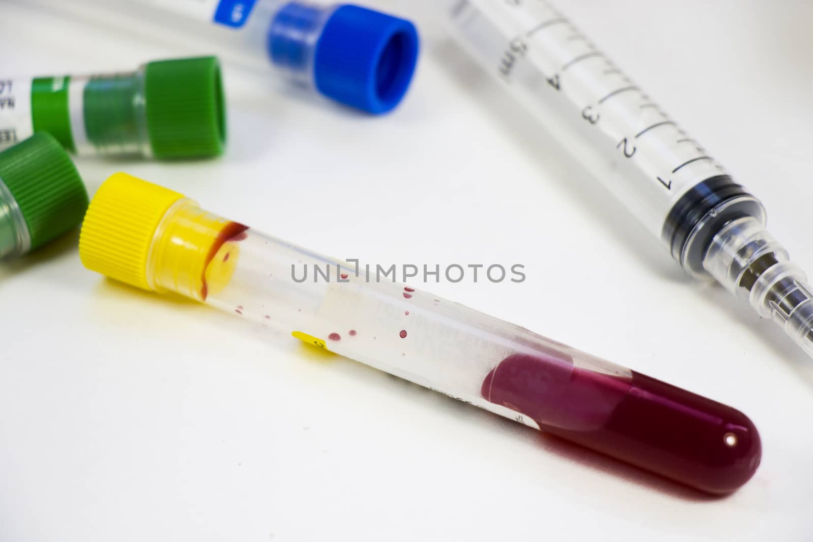 Blood test full tubes samples on the white background, studio shoot.
