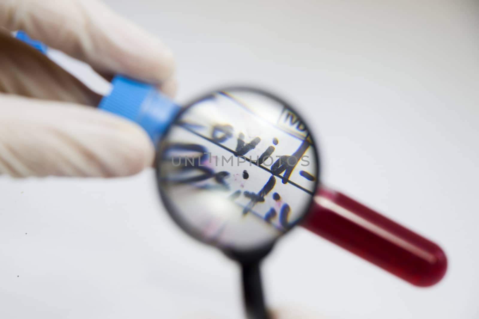 Corona virus positive test samples. Diagnosis and laboratory. Studio shoot, white background. by Taidundua