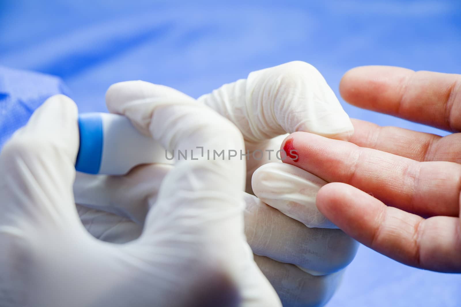 Insulin testing process, blood test and syringe. Injection in the hand. Patients and doctor. Studio shoot.