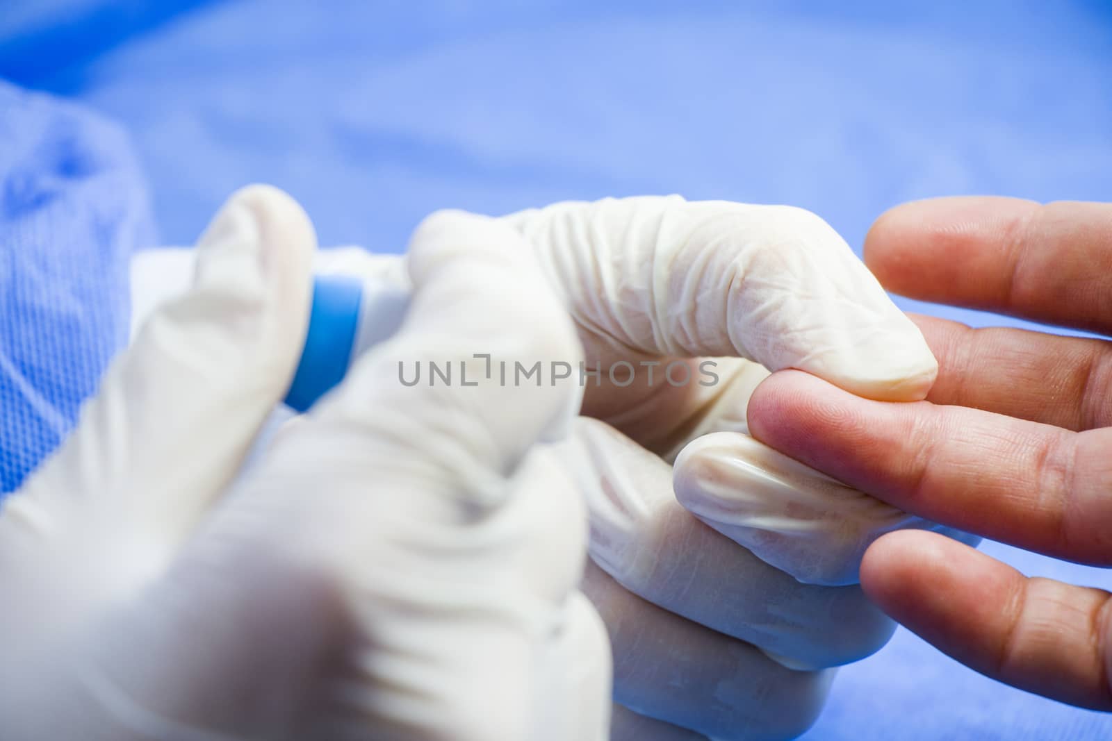 Insulin testing process, blood test and syringe. Injection in the hand. Patients and doctor. Studio shoot.