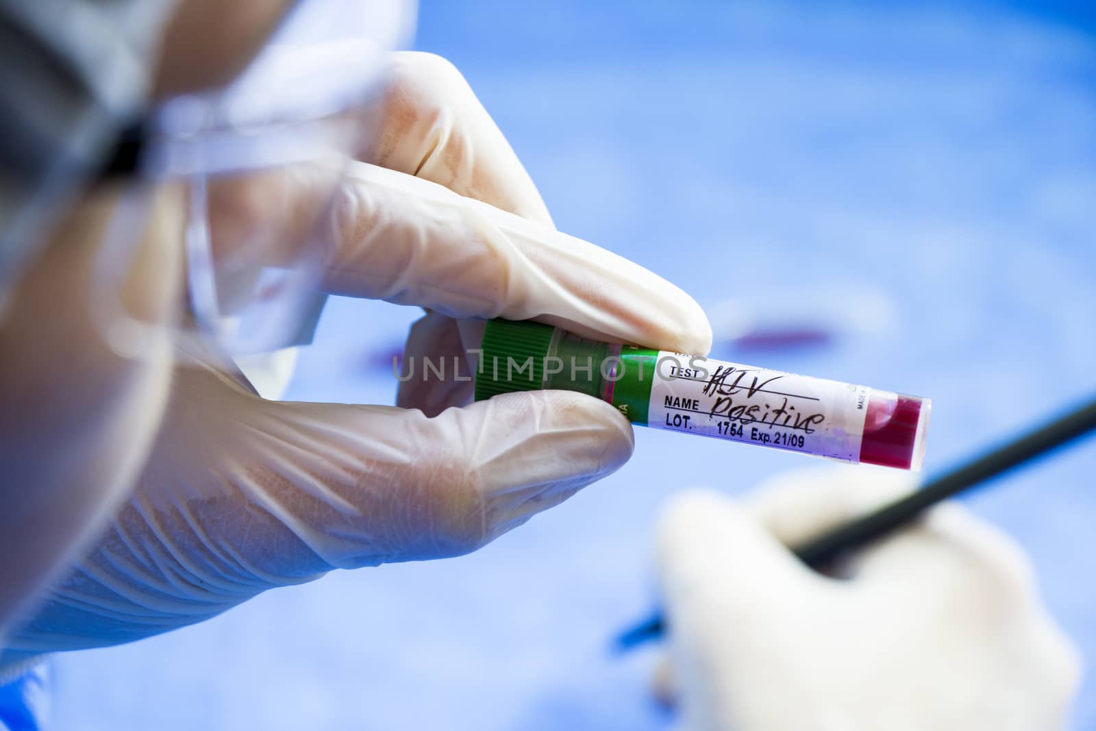 Hiv and aids infection test, doctors face and hand holding tube with blood on the blue background. Studio shoot.