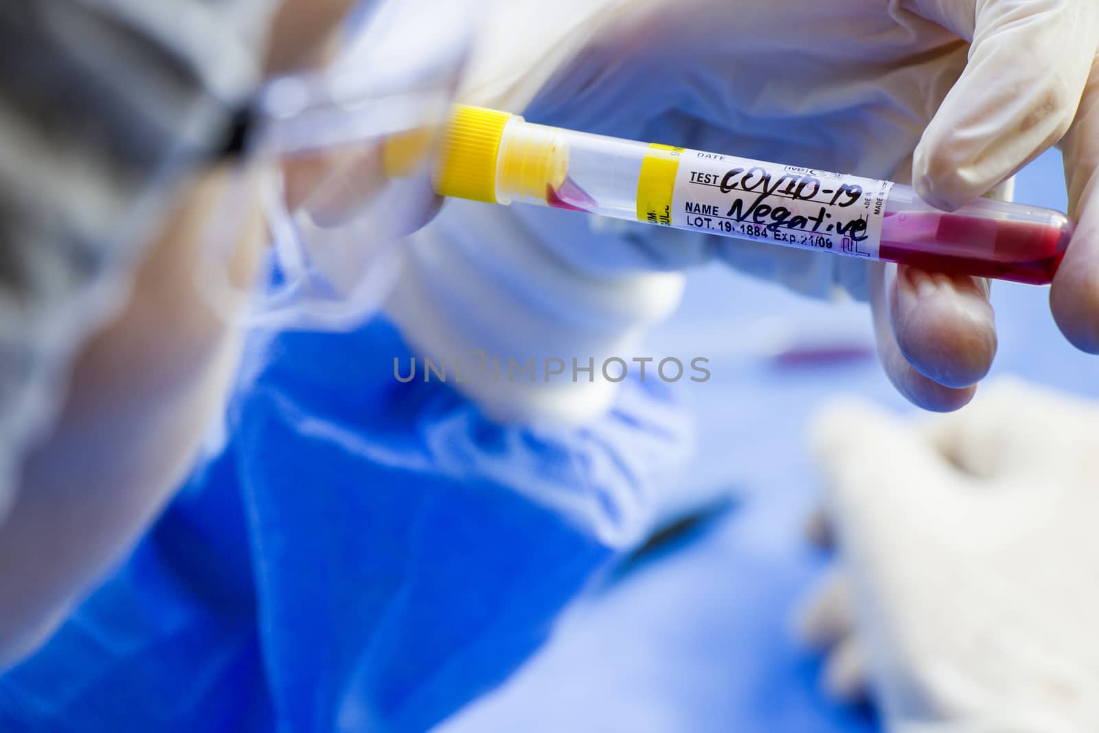 Corona virus negative blood test tubes on the white background, studio shoot. Blood test samples. Diagnosis and laboratory.