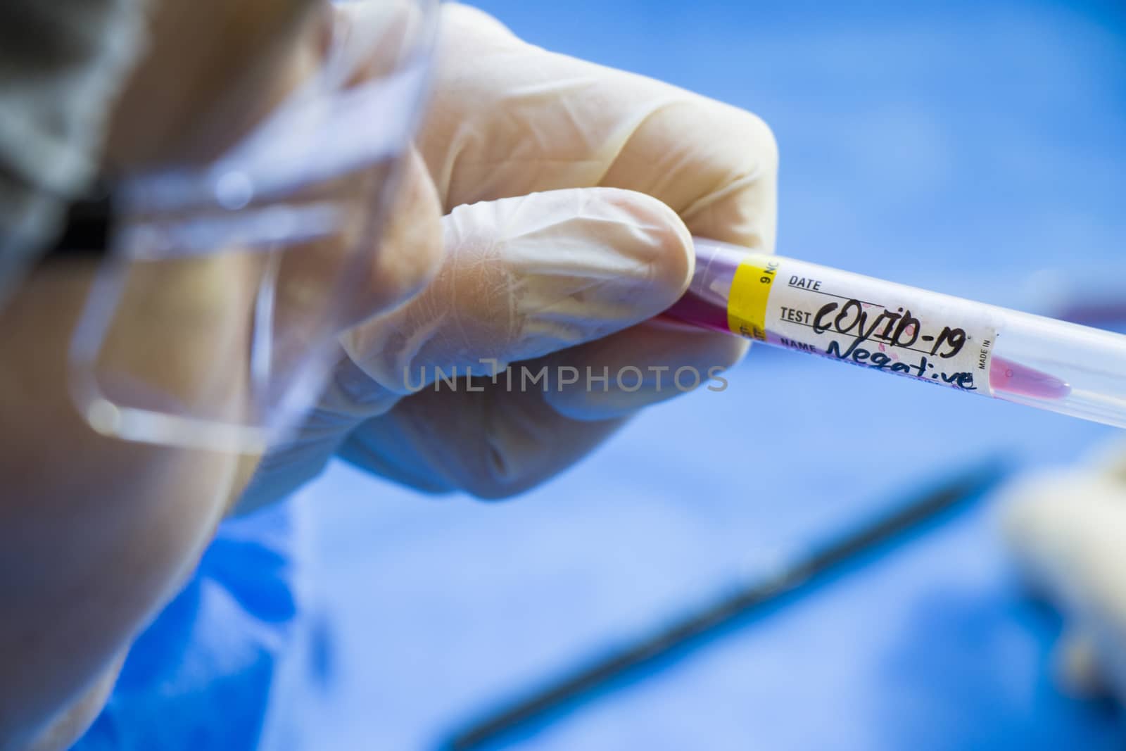 Corona virus negative blood test tubes on the white background, studio shoot. Blood test samples. Diagnosis and laboratory.