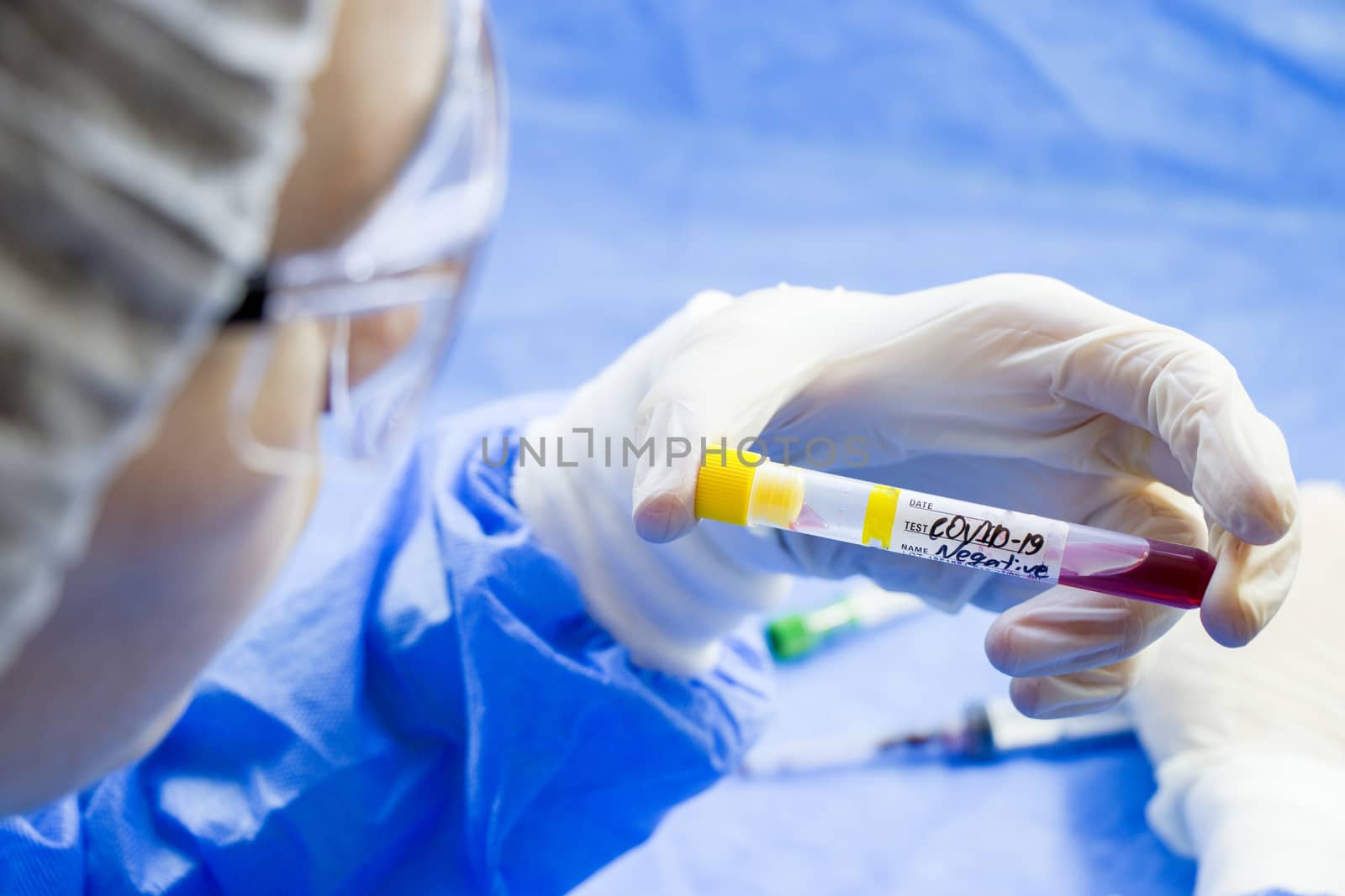 Corona virus negative blood test tubes on the white background, studio shoot. Blood test samples. Diagnosis and laboratory.