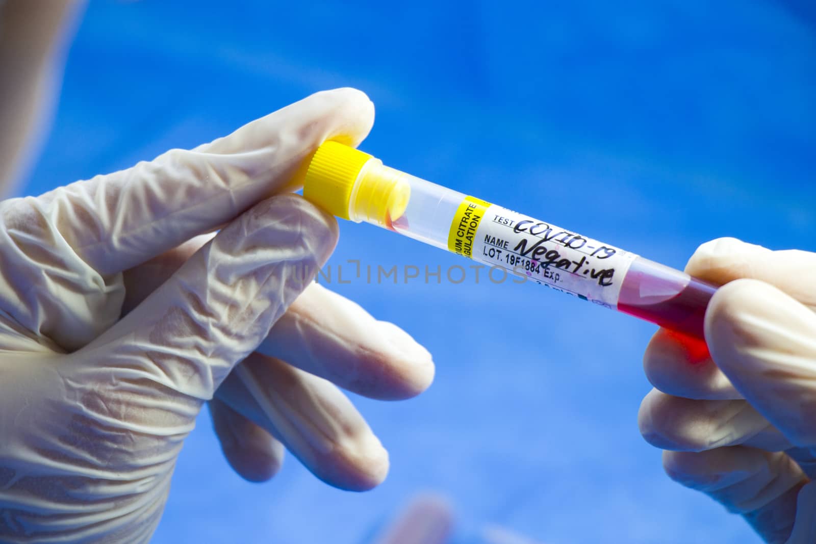 Covid - 19 and corona virus blood test sample, negative and positive by Taidundua