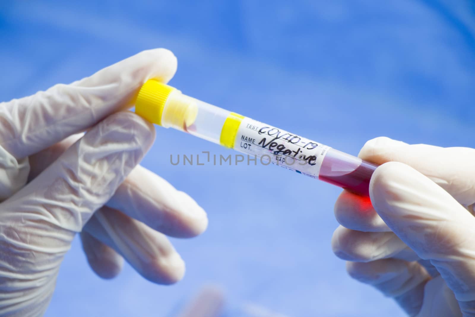 Corona virus negative blood test tubes on the white background, studio shoot. Blood test samples. Diagnosis and laboratory.