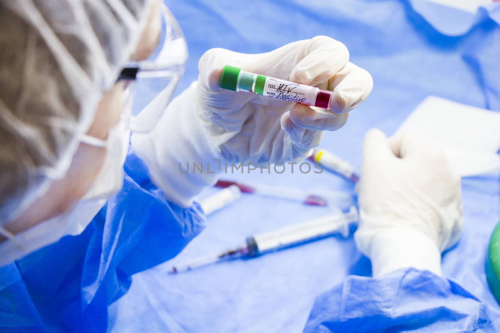 Hiv and aids infection test, doctors face and hand holding tube with blood on the blue background. Studio shoot.