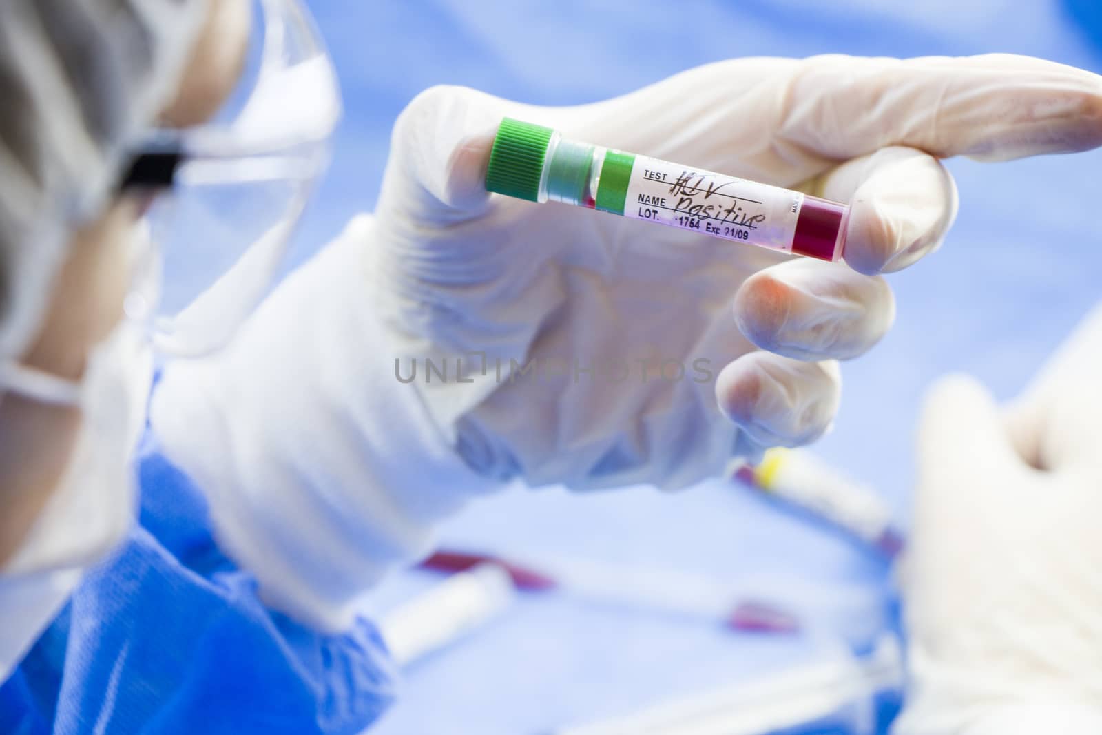 Hiv and aids infection test, doctors face and hand holding tube with blood on the blue background. Studio shoot.