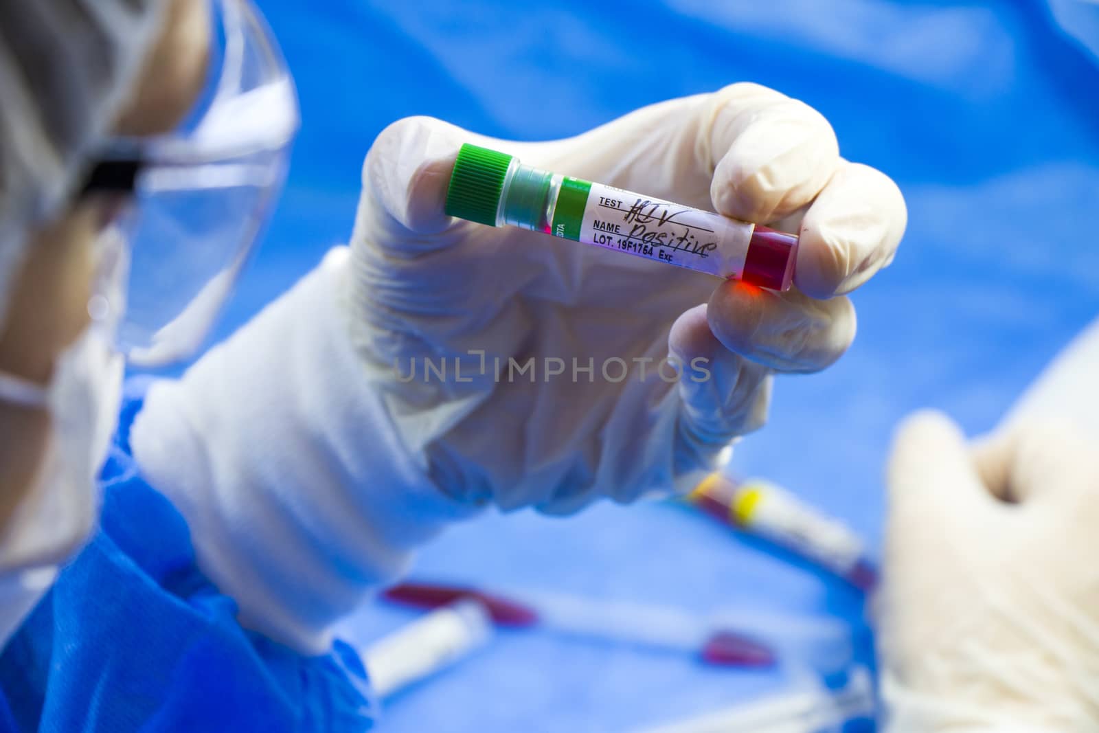 Hiv and aids infection test, doctors face and hand holding tube with blood on the blue background. Studio shoot.