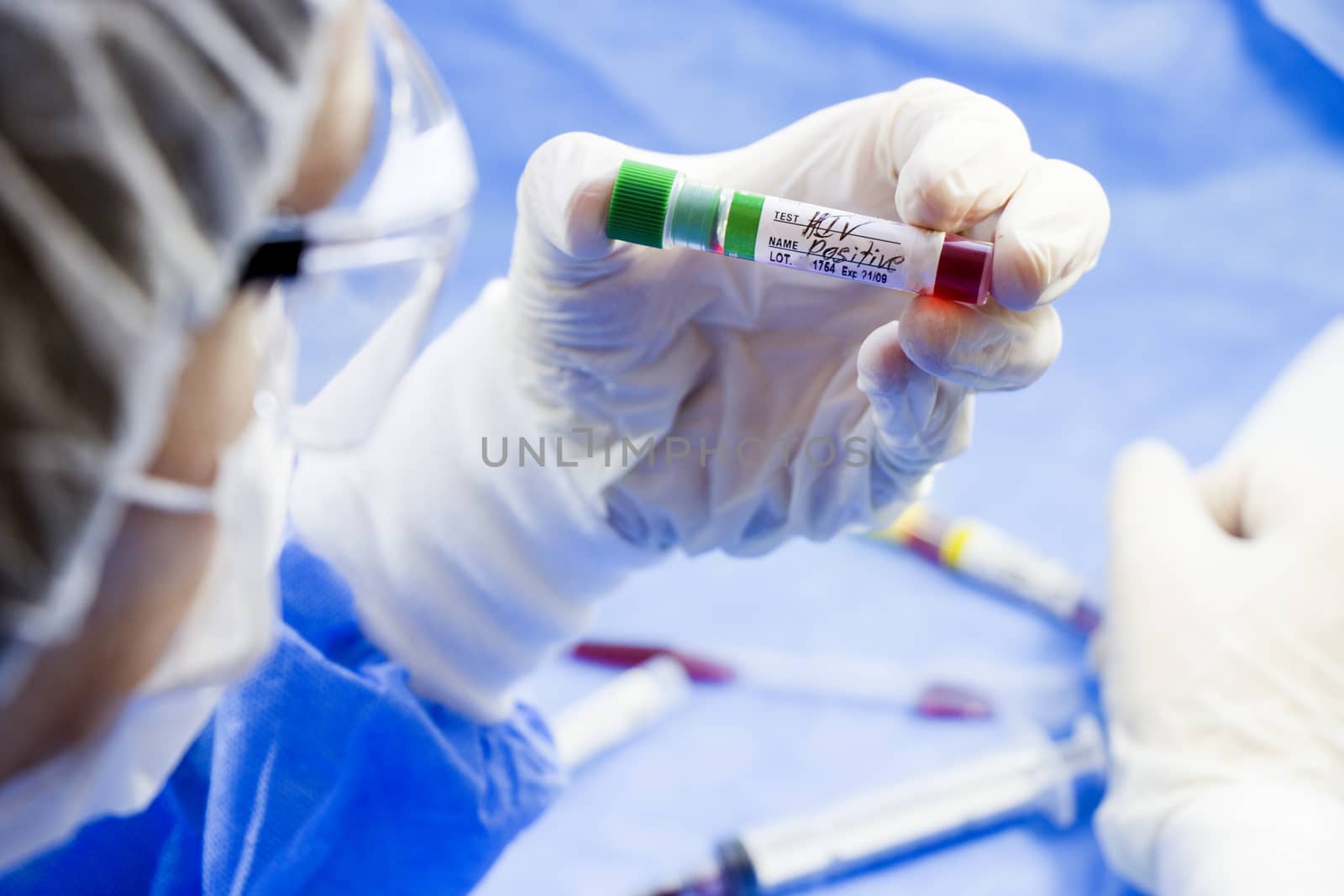 Hiv and aids infection test, doctors face and hand holding tube with blood on the blue background. Studio shoot.