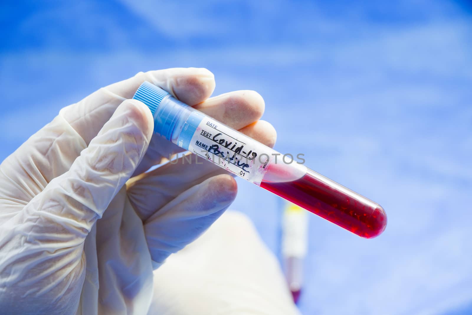 Covid - 19 and corona virus blood test sample, negative and positive by Taidundua