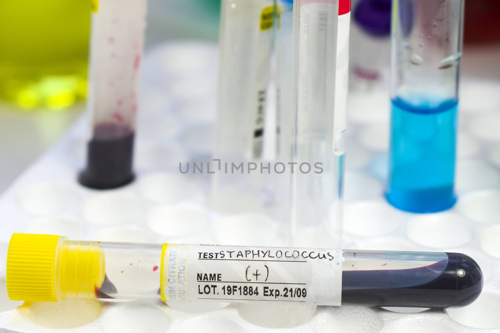 Staphylococci bacteria, blood test tube samples, laboratory and chemical liquid elements, cocci by Taidundua