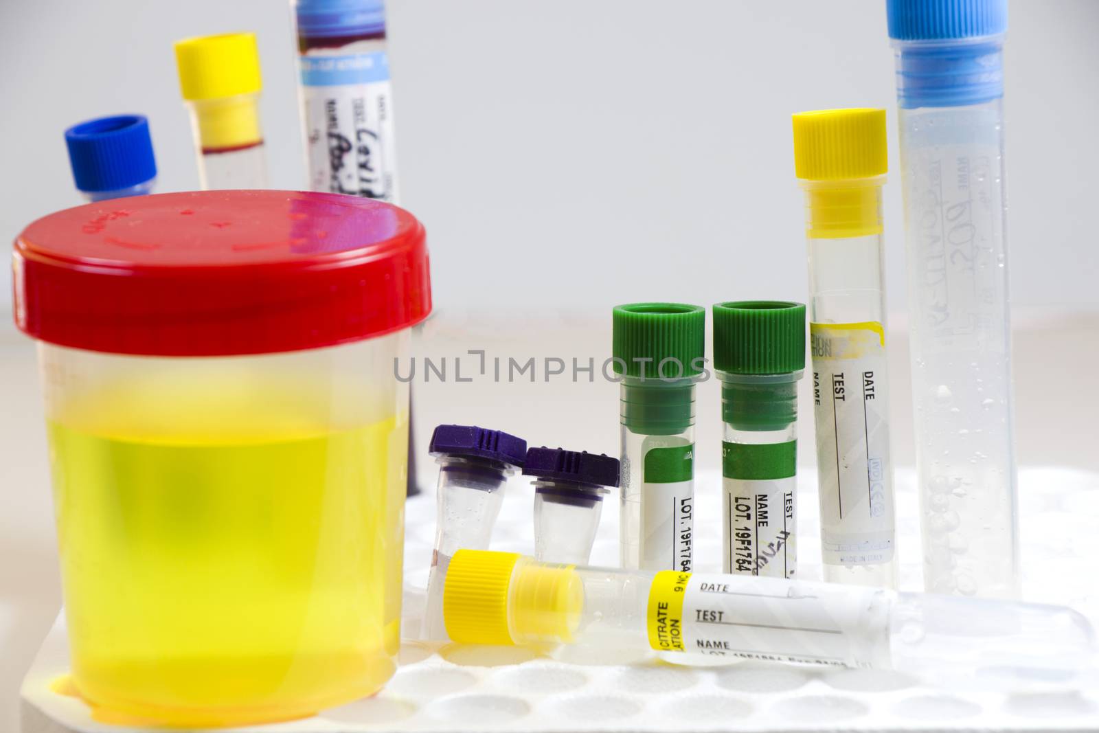 Drug test, medical urine and pee test with blood and other tubes on the white background, colorful lab test containers by Taidundua
