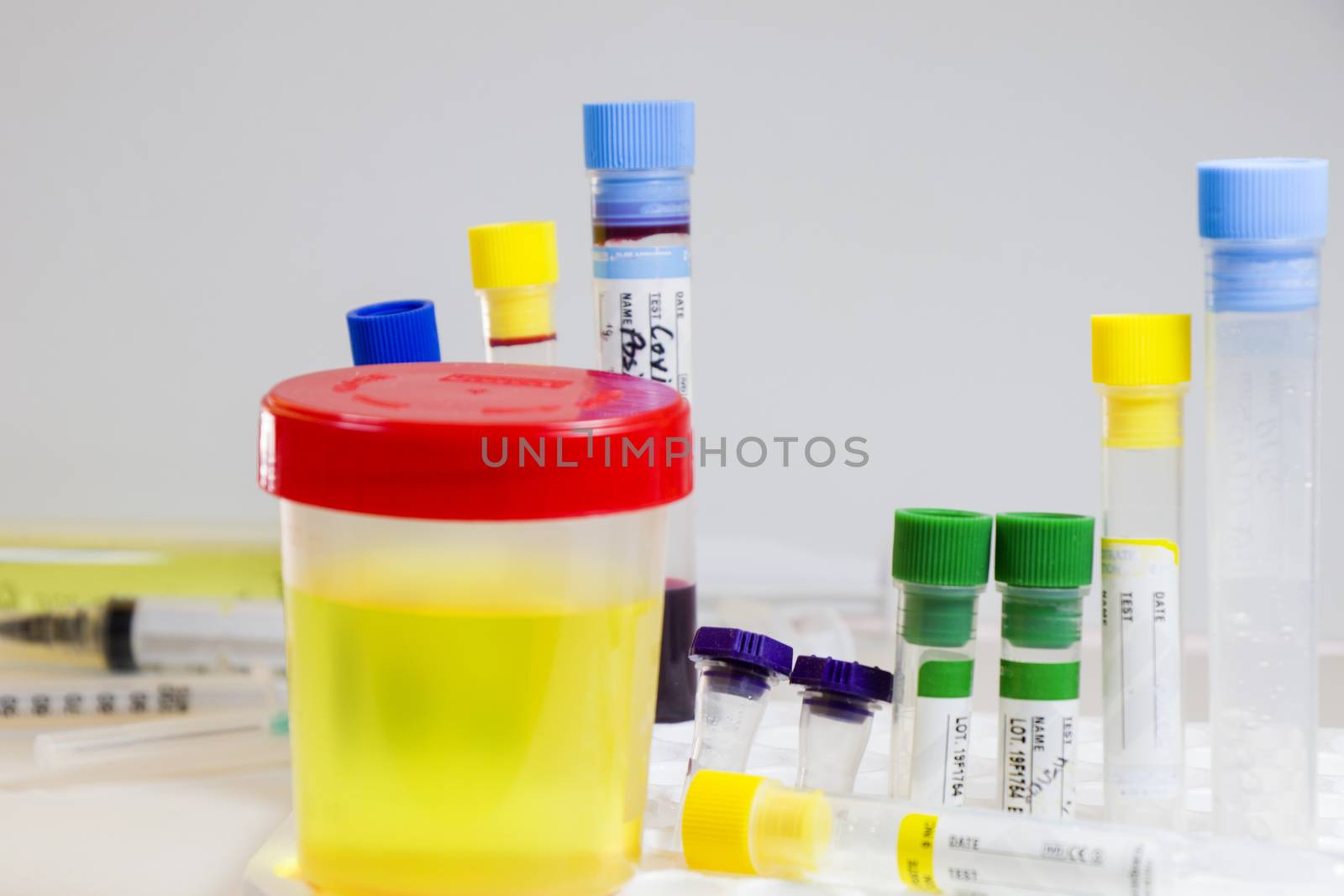 Drug test, medical urine and pee test with blood and other tubes on the white background, colorful lab test containers, viruses and doping laboratory tests. Covid 19, HIV, aids and other infections
