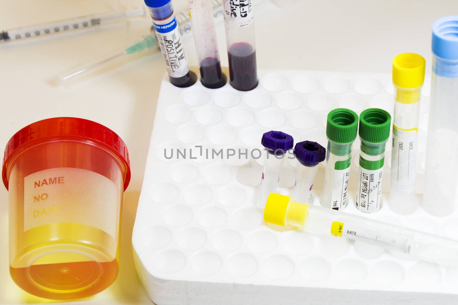 Drug test, medical urine and pee test with blood and other tubes on the white background, colorful lab test containers by Taidundua