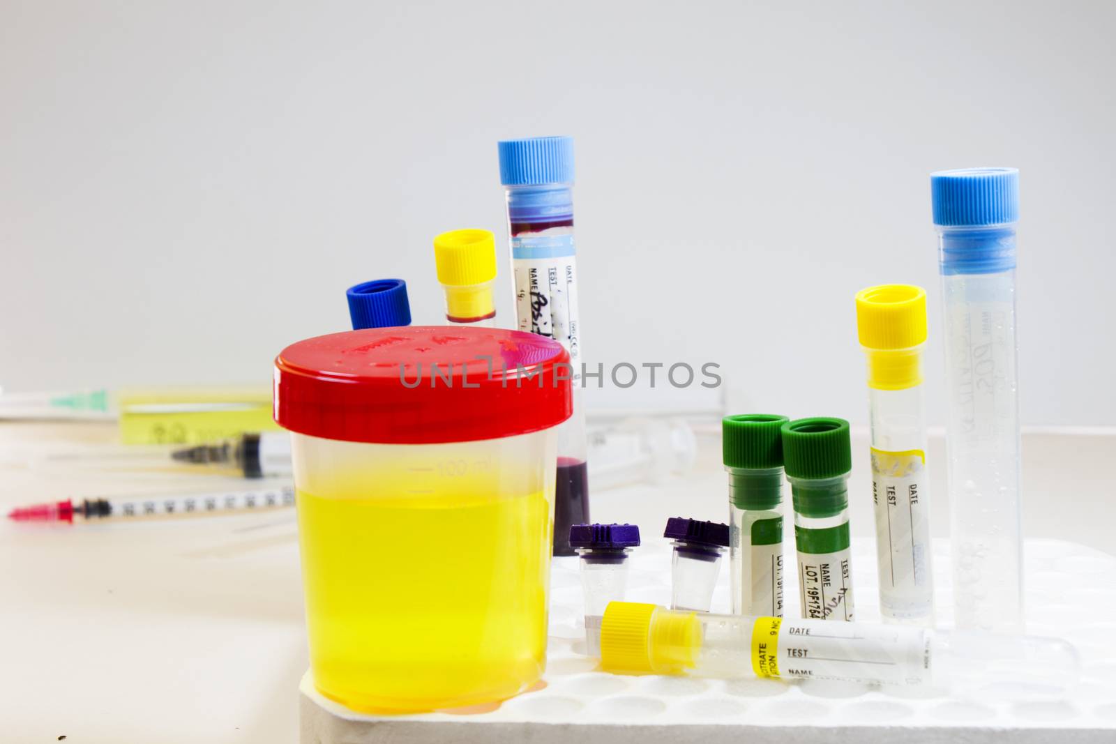 Drug test, medical urine and pee test with blood and other tubes on the white background, colorful lab test containers, viruses and doping laboratory tests. Covid 19, HIV, aids and other infections