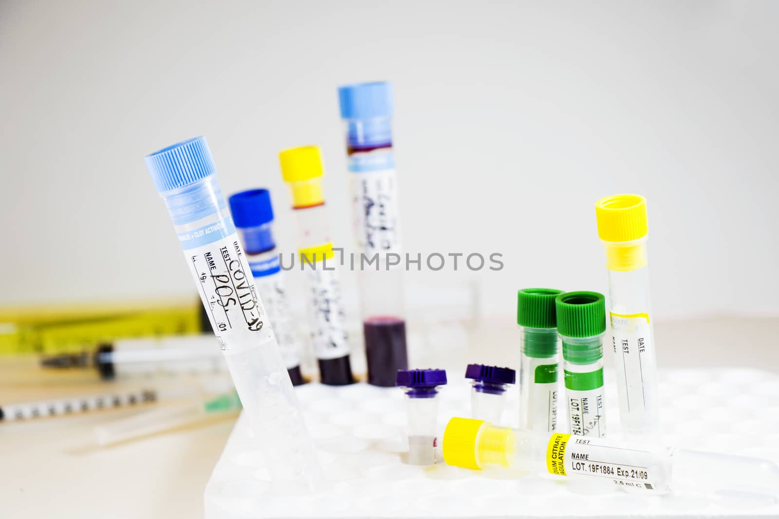 Corona virus, NCOV and Covid - 19 positive test samples. Blood tube samples. by Taidundua