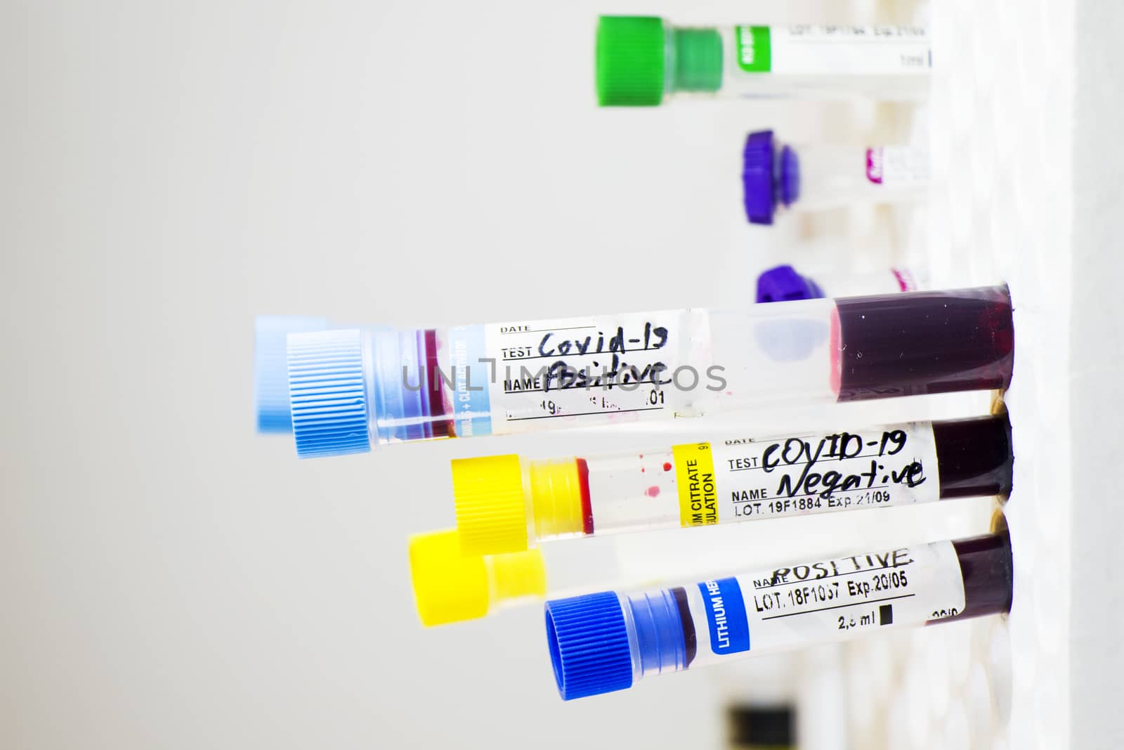 Corona virus, NCOV and Covid - 19 positive test samples. Blood tube samples. by Taidundua