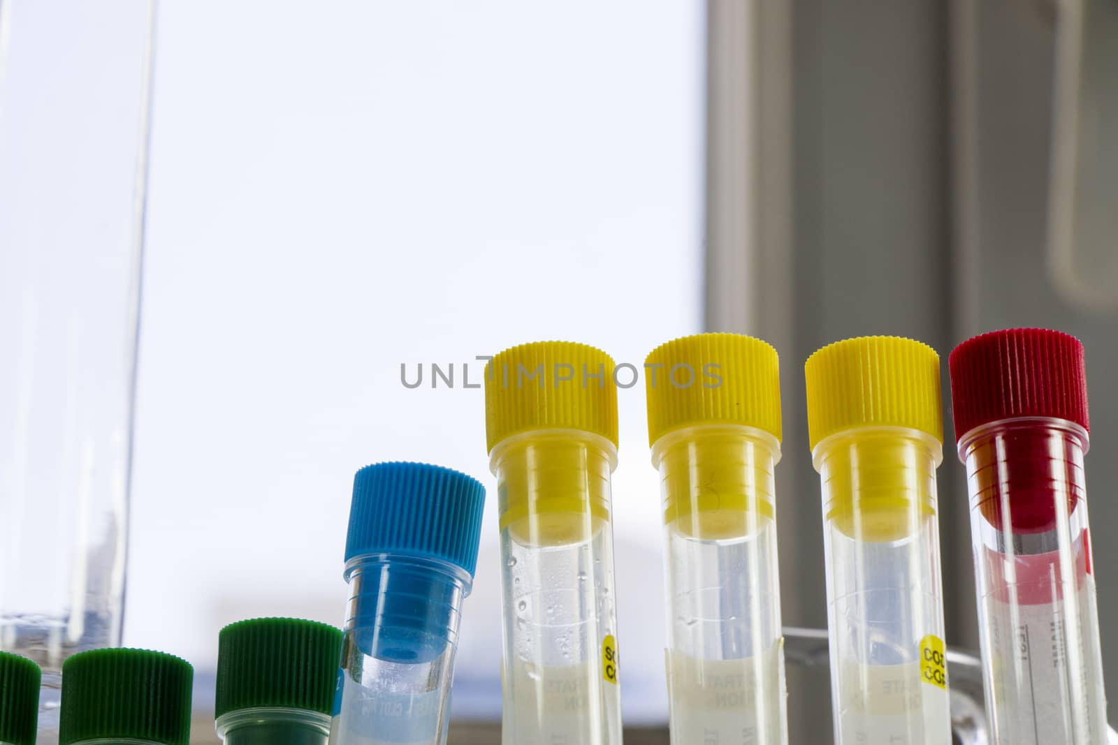 Laboratory blood test tube samples, research diagnoses, instruments and objects in the sterile table by Taidundua