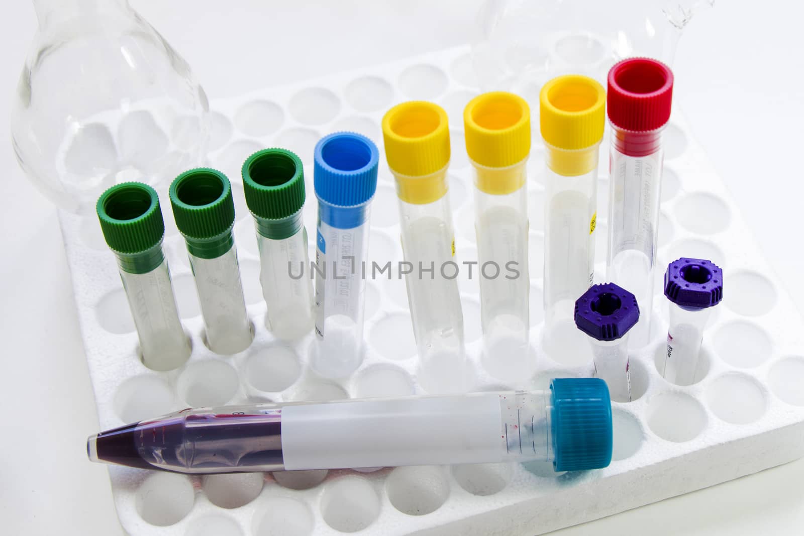 Laboratory blood test tube samples, research diagnoses, instruments and objects in the sterile table Studio shoot.