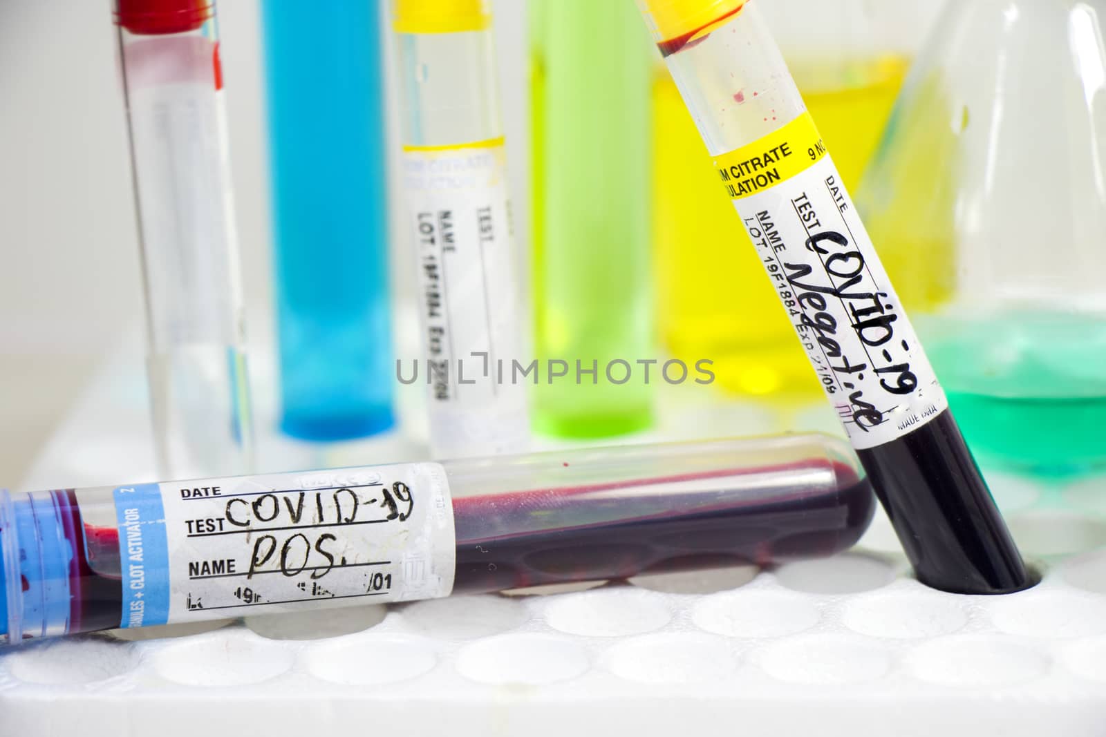 Corona virus and Covid-19 positive blood test tubes on the white background, studio shoot. Blood test samples. Diagnosis and laboratory. Chemical elements.