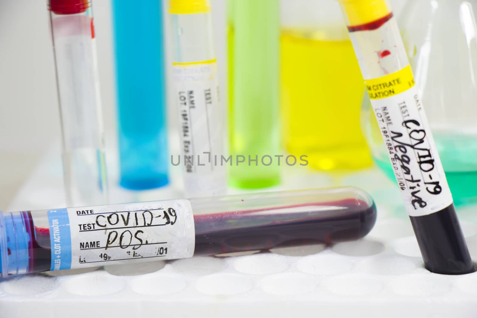 Covid - 19 and corona virus blood test sample, negative and positive tests, reagents and glassware.