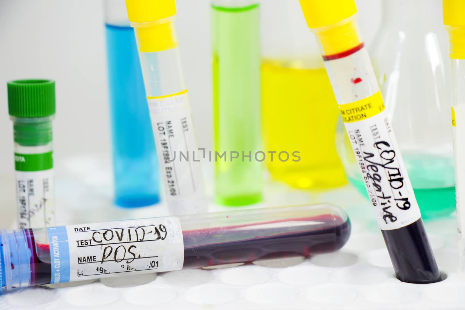 Covid - 19 and corona virus blood test sample, negative and positive tests, reagents and glassware.