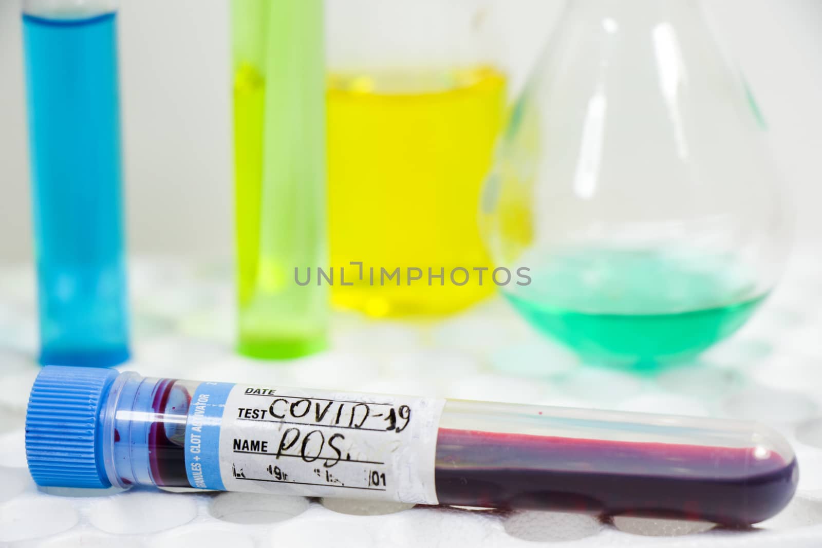 Covid - 19, coronavirus, covid blood test tube sample, laboratory diagnosis. Sars viruses. by Taidundua