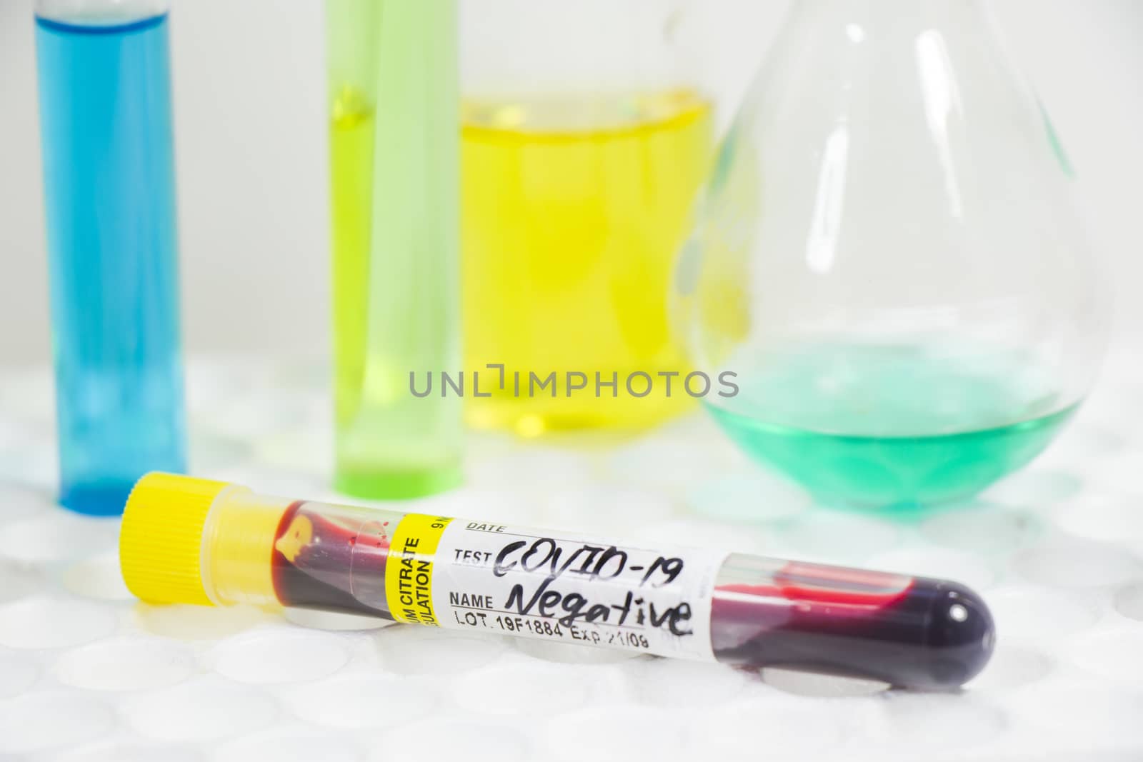 Covid - 19, coronavirus, covid blood test tube sample, laboratory diagnosis.