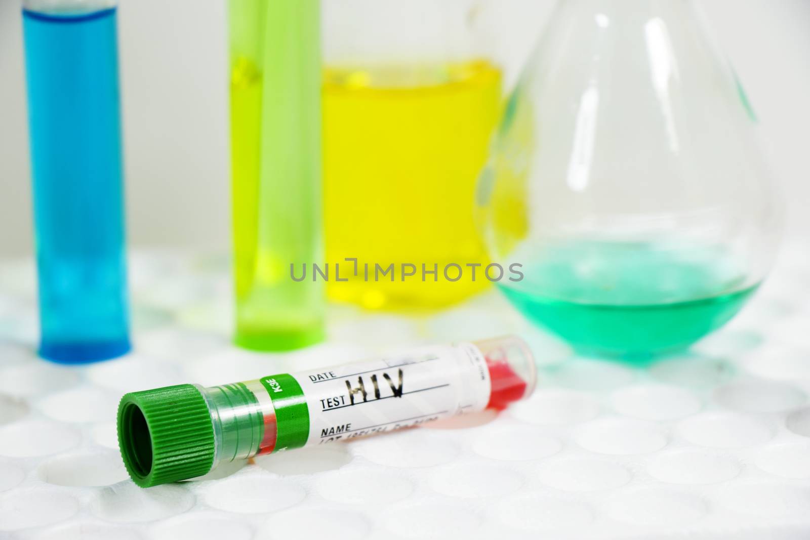 HIV blood test tube sample, aids immune viruses.