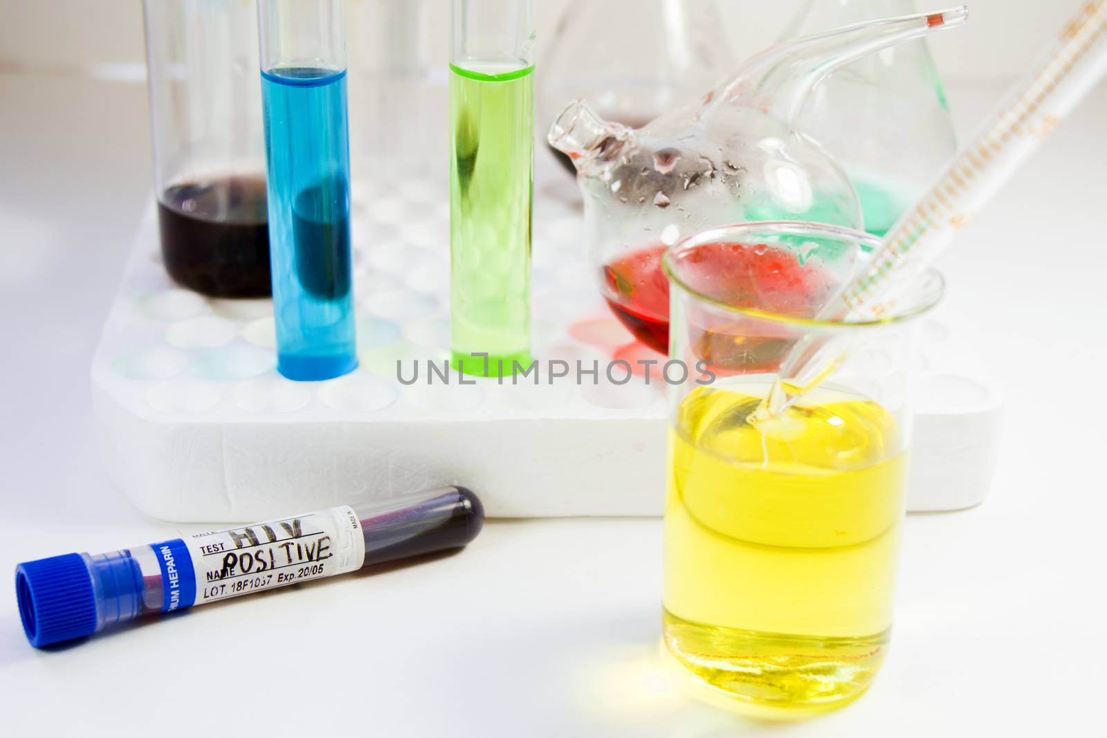HIV test blood tube and laboratory glasses, instruments and viruses research, studio shoot.
