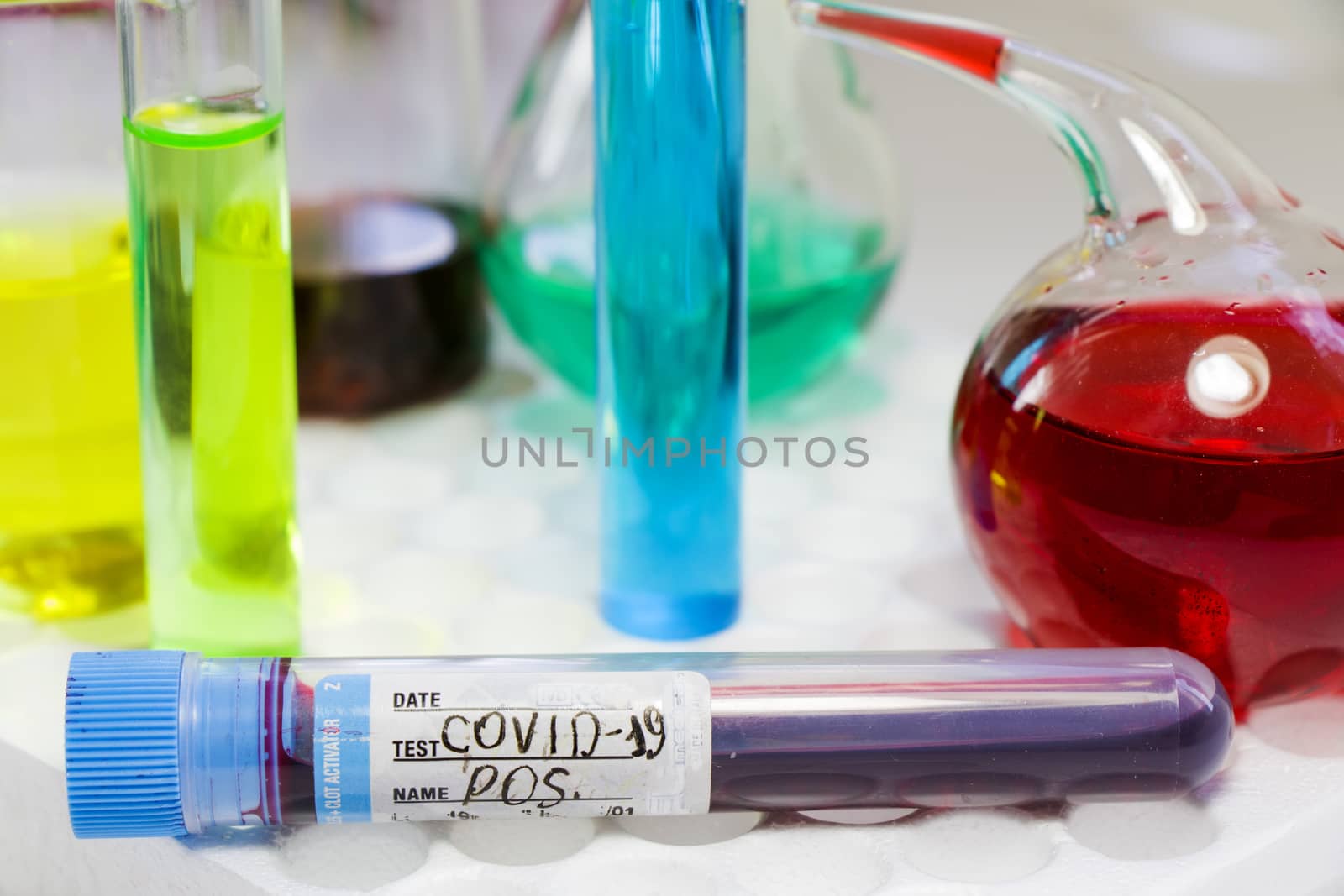 Covid - 19, coronavirus, covid blood test tube sample, laboratory diagnosis. Sars viruses. by Taidundua