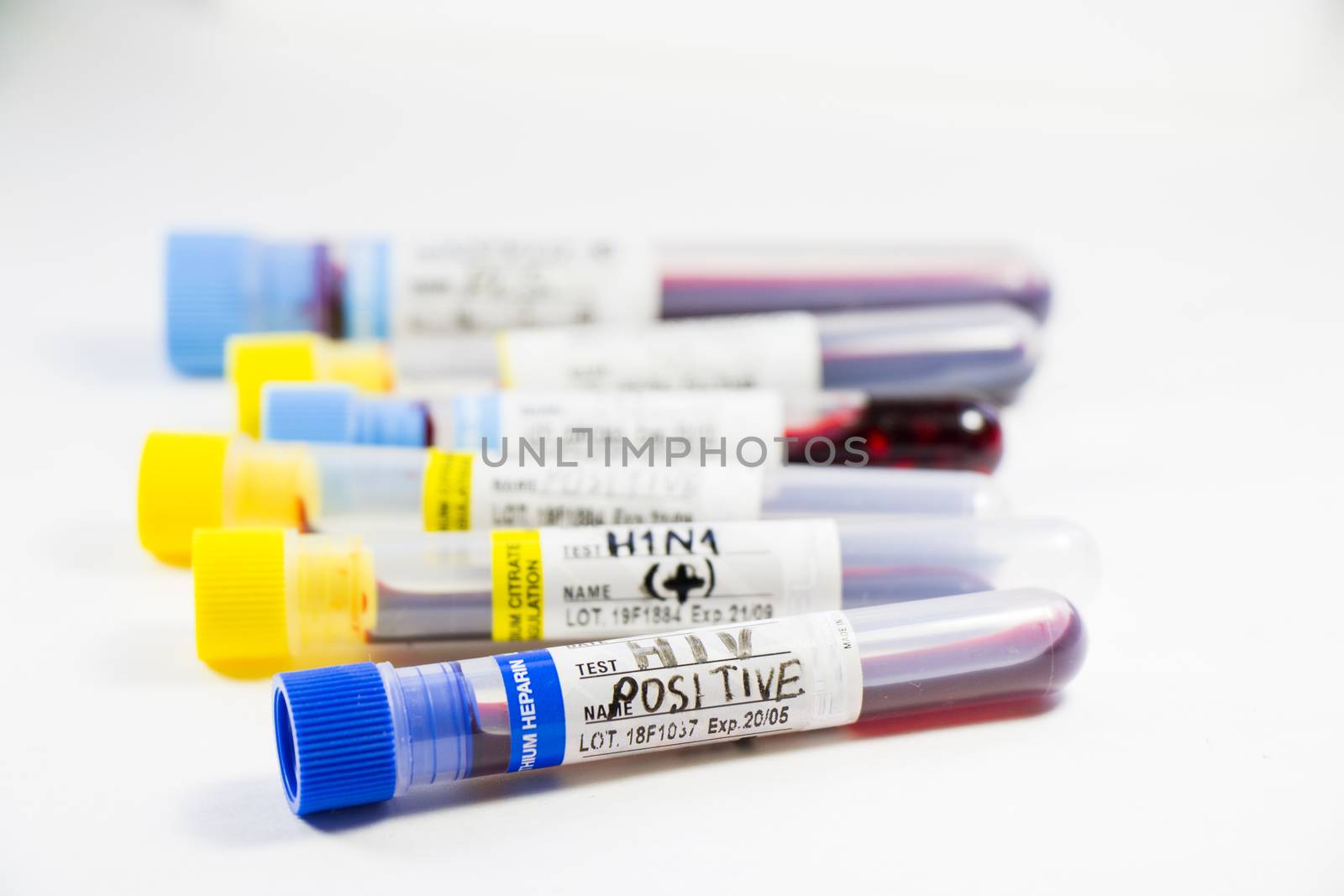 Hiv and aids infection blood test sample, diagnoses and laboratory chemical liquid elements, studio shoot on the white background