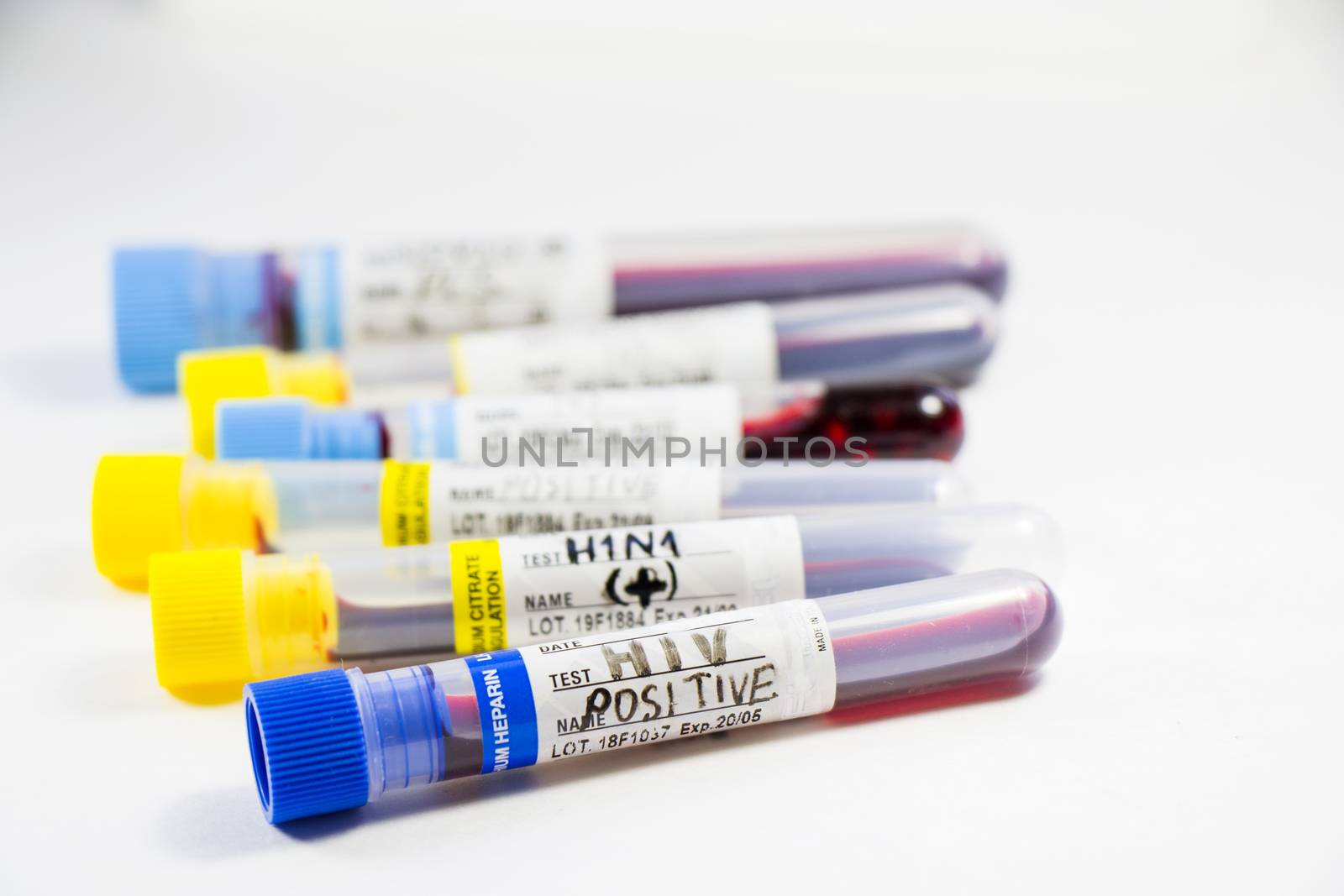 H1N1, Covid-19, Hepatitis C, Tuberculosis and Staphylococcus viruses blood tests in the tubes, laboratory diagnostics, texts and letter.