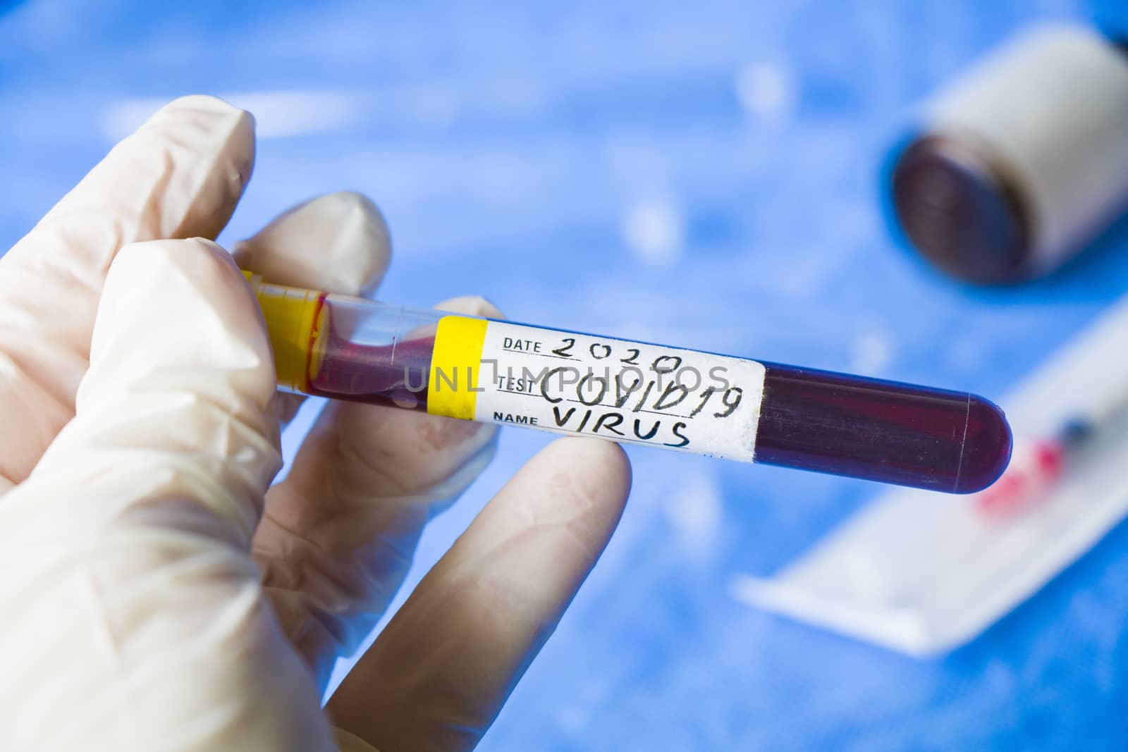 Corona virus negative blood test tubes on the white background, studio shoot. Blood test samples. Diagnosis and laboratory.