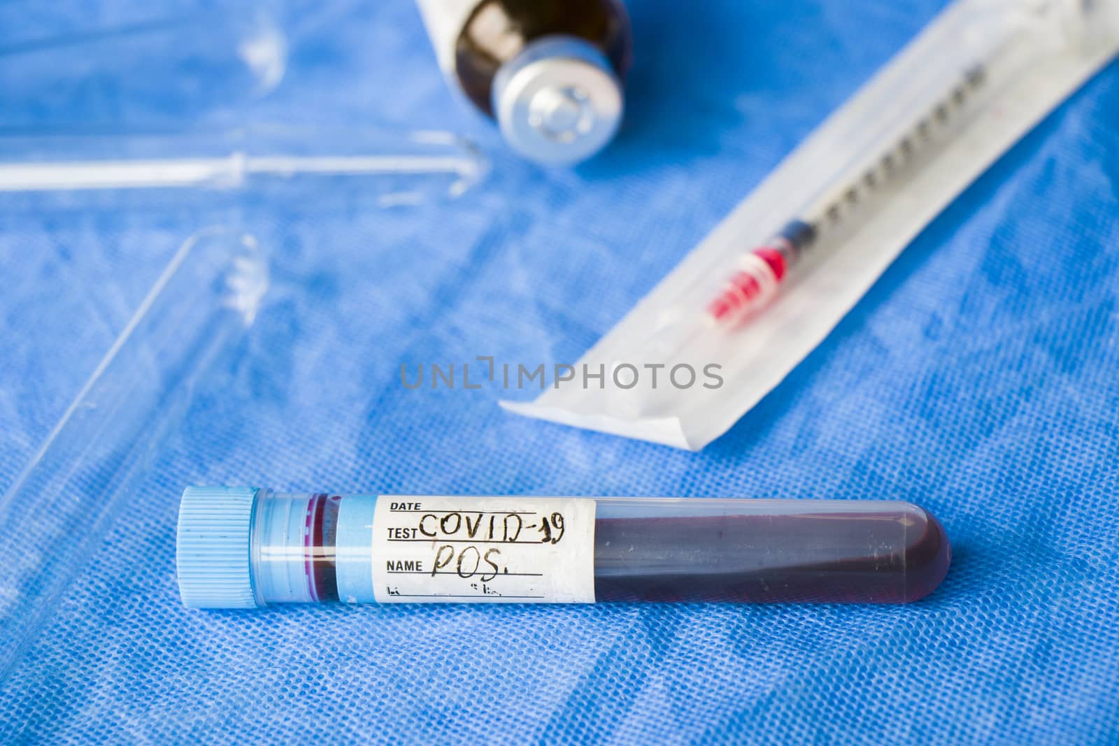 Corona virus positive blood test tubes on the white background, studio shoot. Blood test samples. Diagnosis and laboratory.