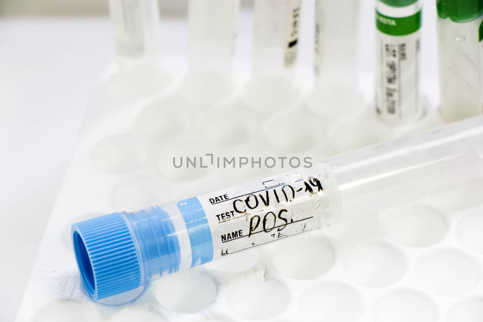 Corona virus and Covid-19 positive blood test tubes on the white background, studio shoot. Blood test samples. Diagnosis and laboratory.