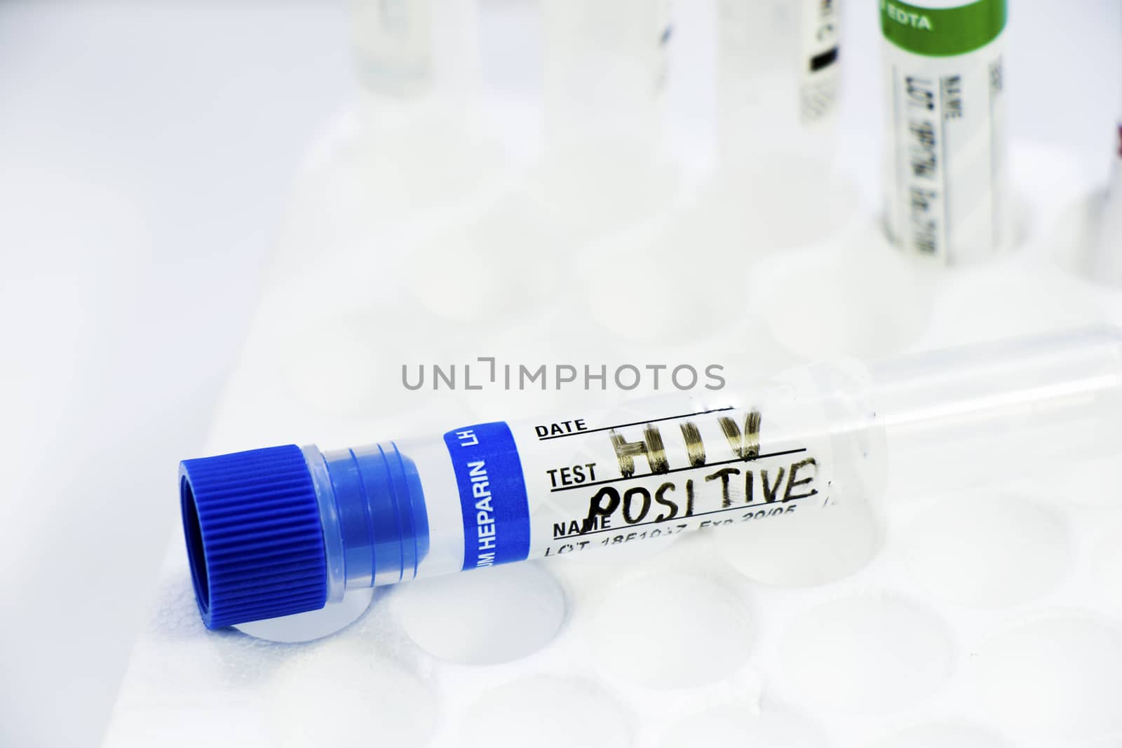 Hiv and aids infection test, doctors face and hand holding tube with blood on the blue background. Studio shoot.