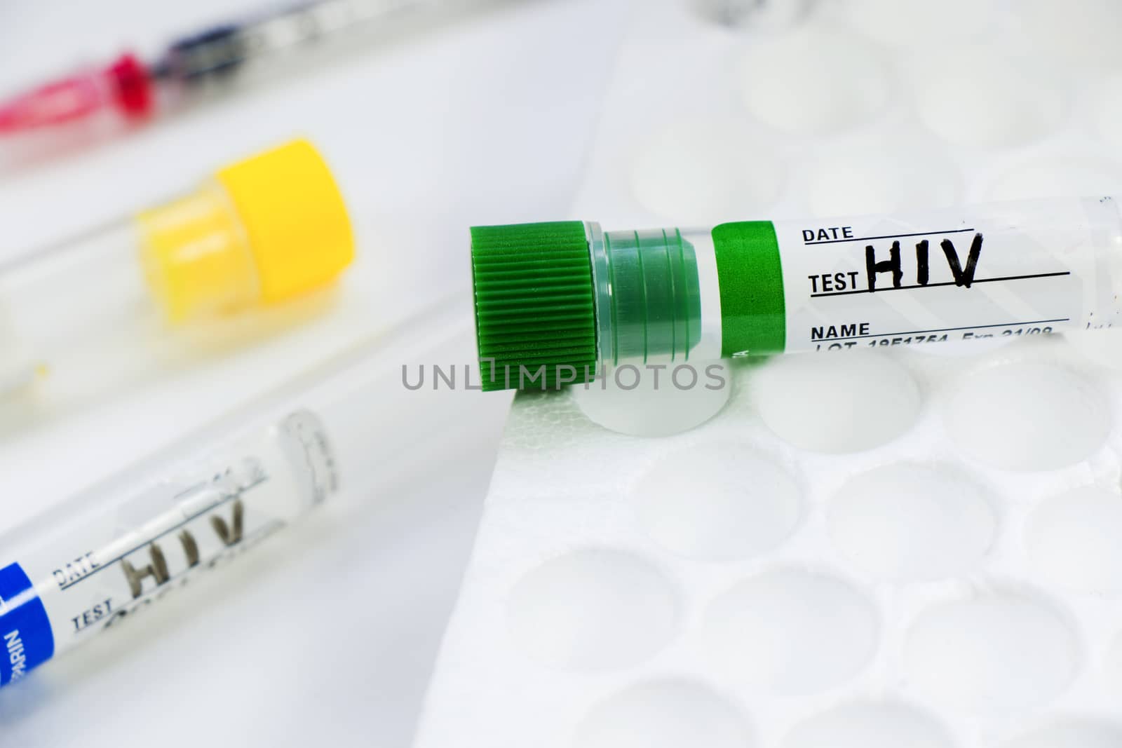 Hiv and aids infection test, doctors face and hand holding tube  by Taidundua