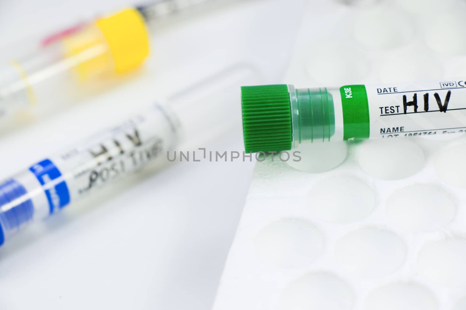 Hiv and aids infection test, doctors face and hand holding tube with blood on the blue background. Studio shoot.