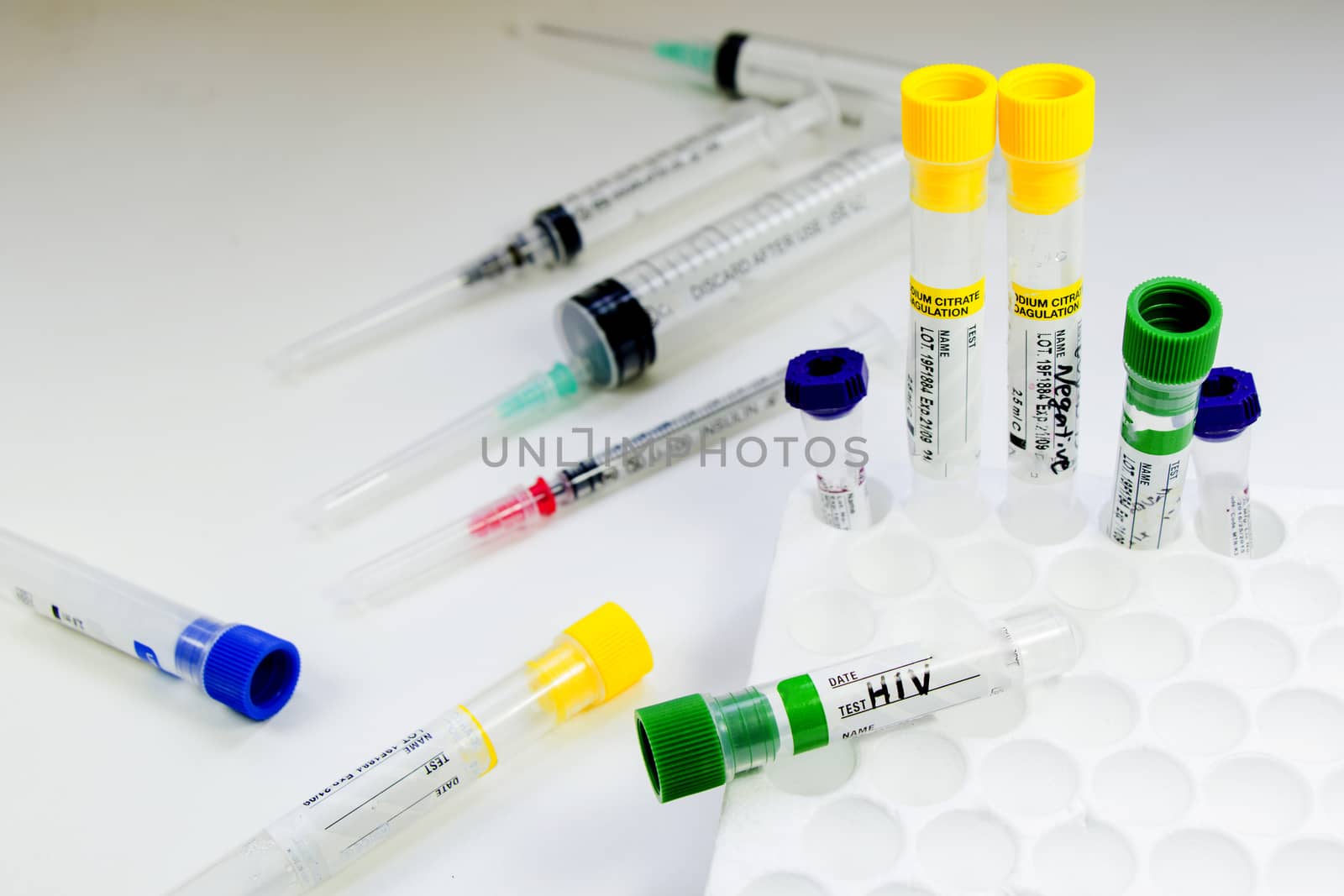 Hiv and aids infection test, doctors face and hand holding tube  by Taidundua