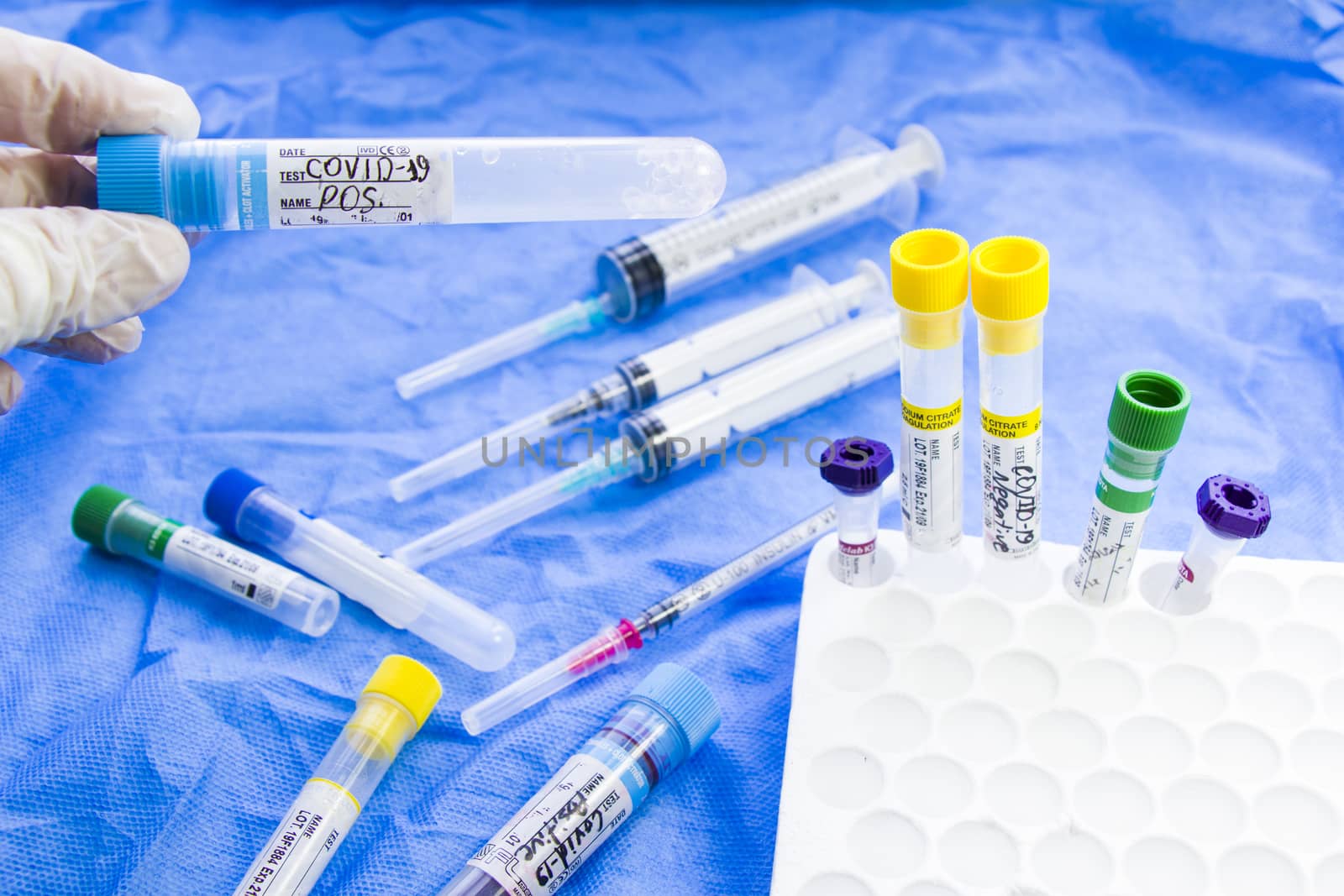 Corona virus and Covid-19 positive test samples. Diagnosis and laboratory. Studio shoot, white background. by Taidundua