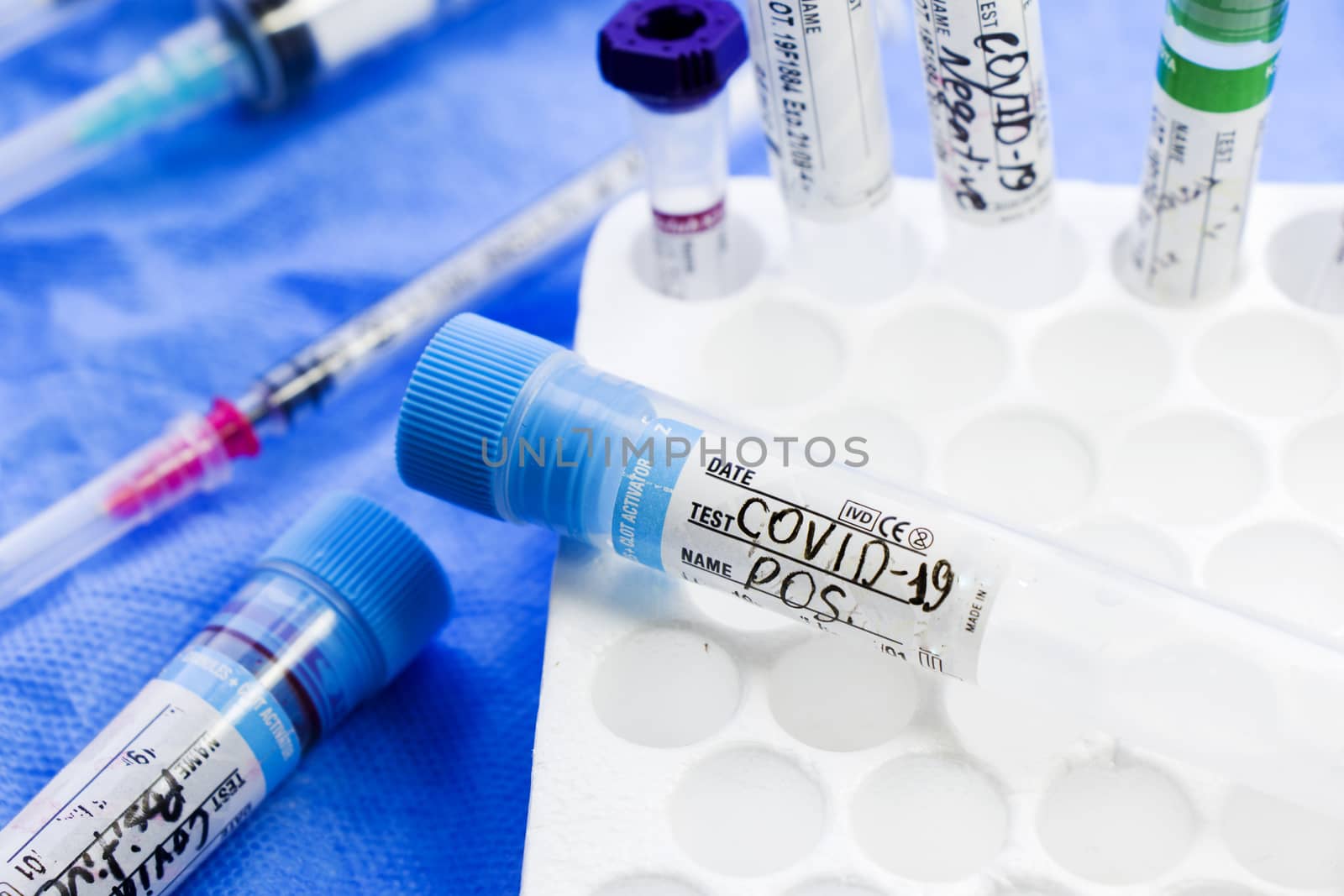 Corona virus and Covid-19 positive test samples. Diagnosis and laboratory. Studio shoot, white background. by Taidundua