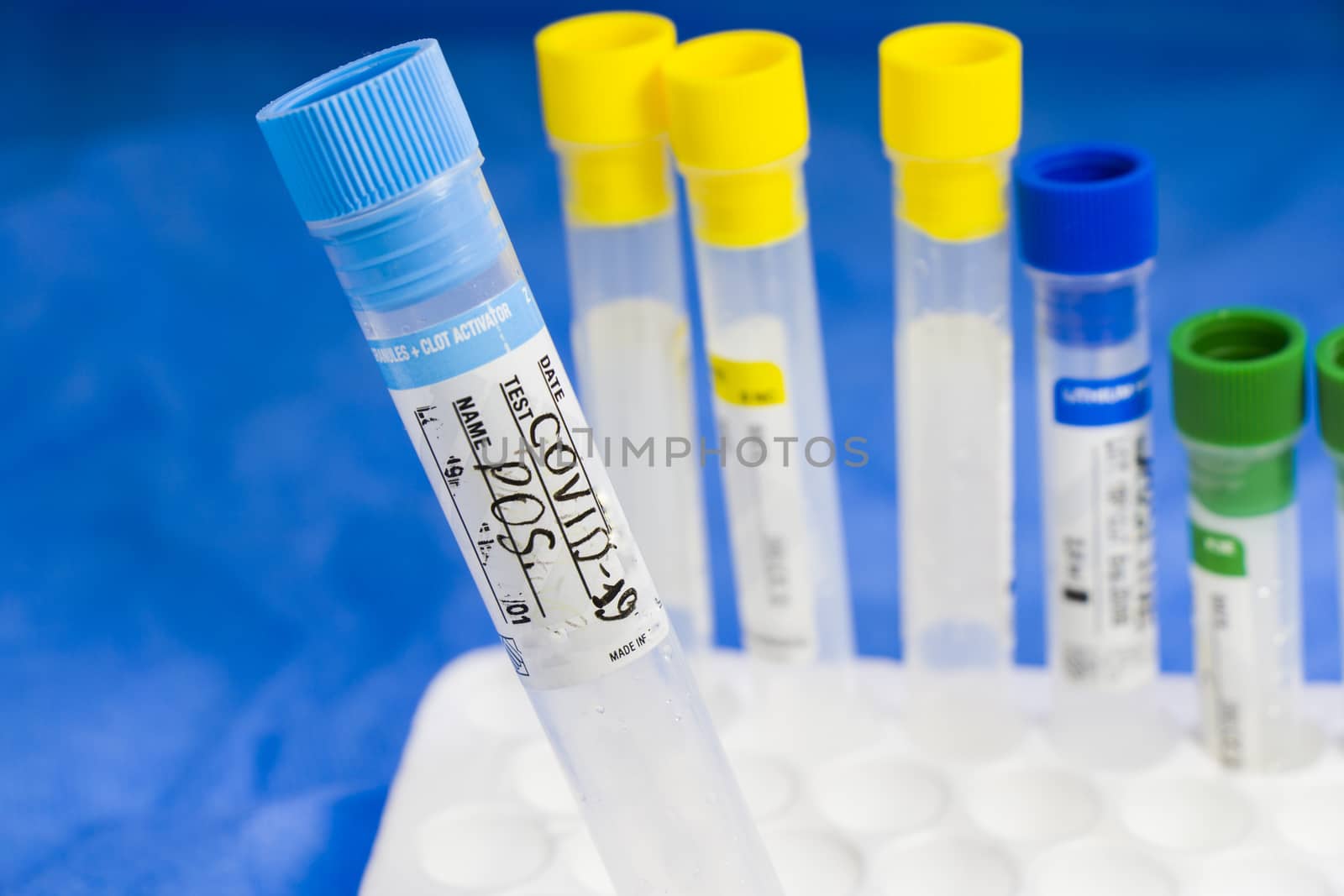 Corona virus and Covid-19 positive test samples. Tubes of blood. by Taidundua